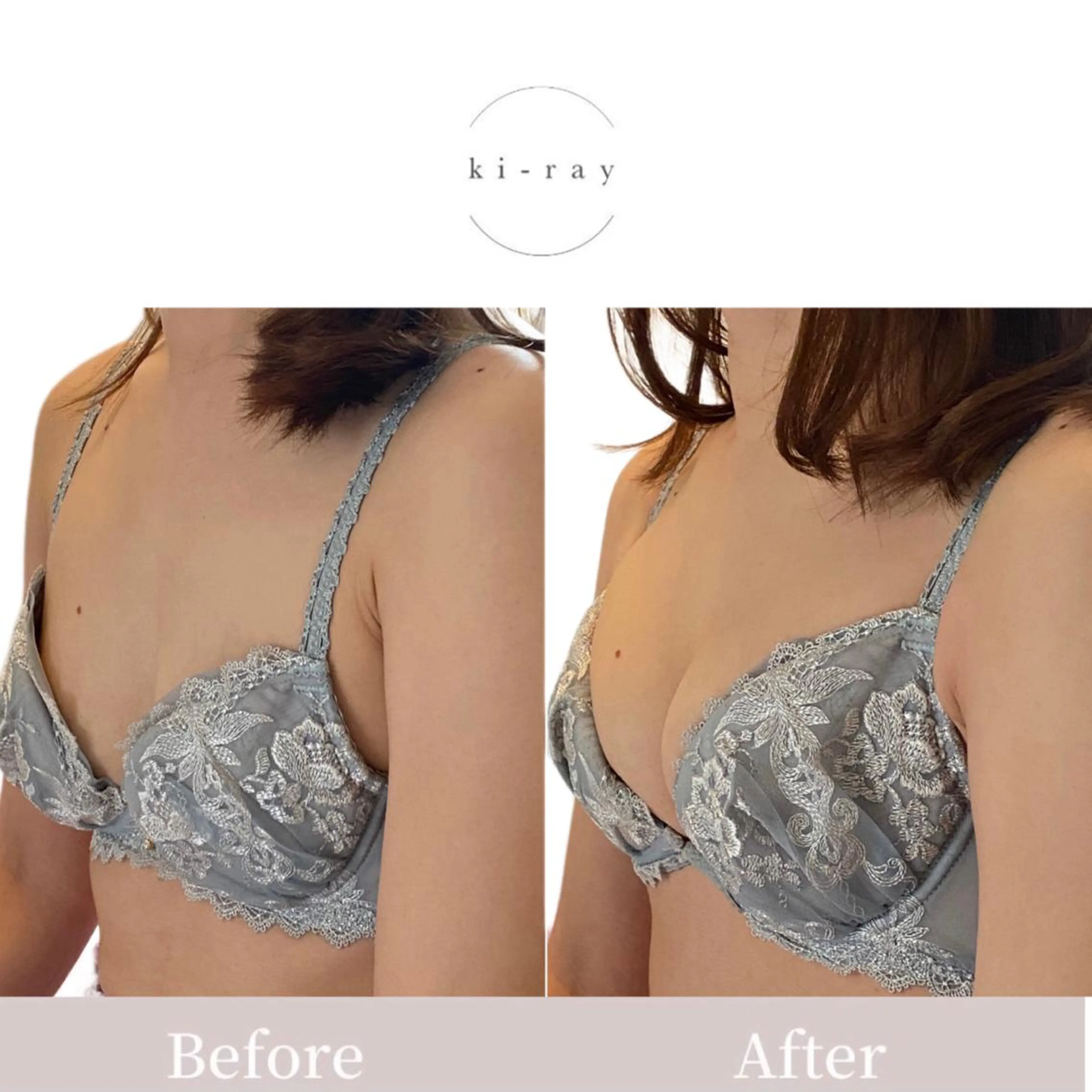 エステ 綺麗のひみつ グランプリ受賞店のエステ・リラクイメージ