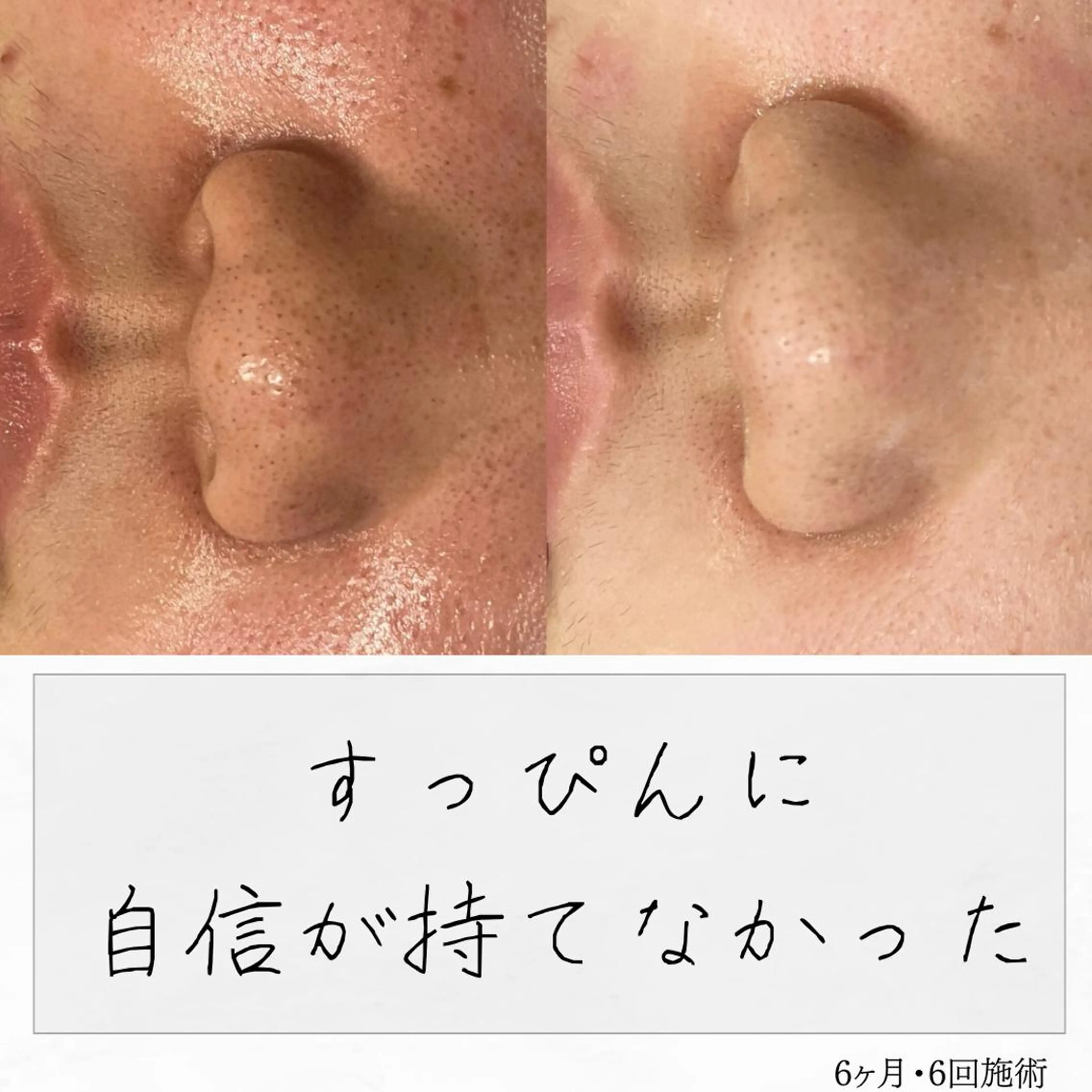 ニキビ経験者が施術 する専門サロン🌻のエステ・リラクイメージ