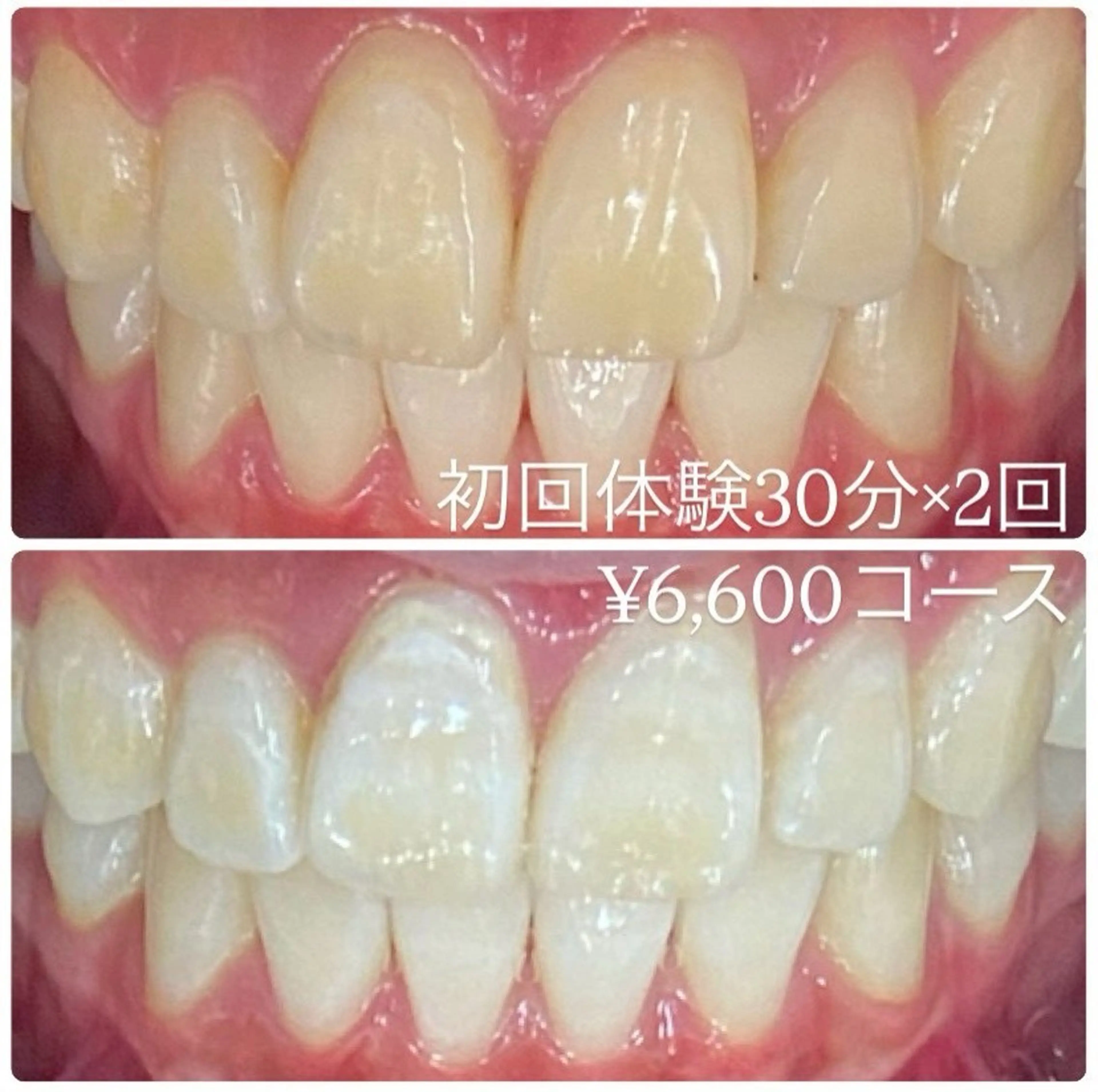 メンズ ホワイトニング ルーム　川崎店のその他イメージ