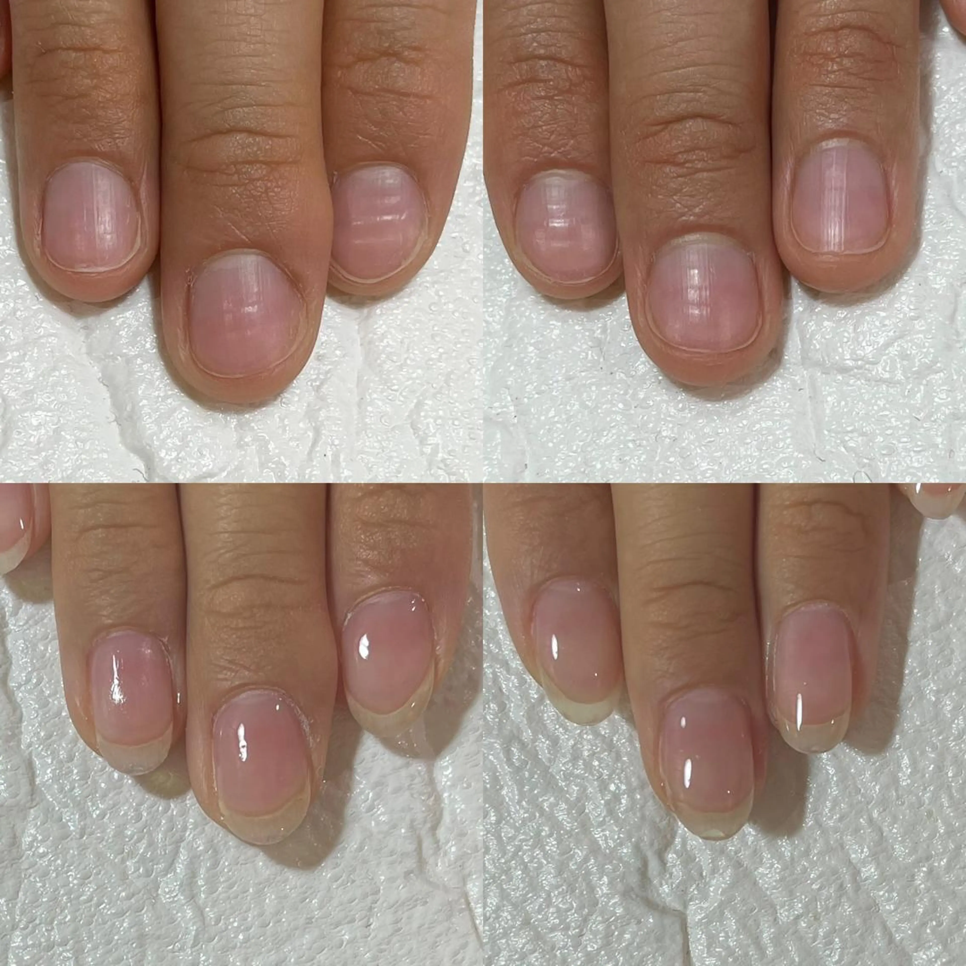 ネイル 自爪育成・巻き爪 補正講師　津蔵のネイルデザイン