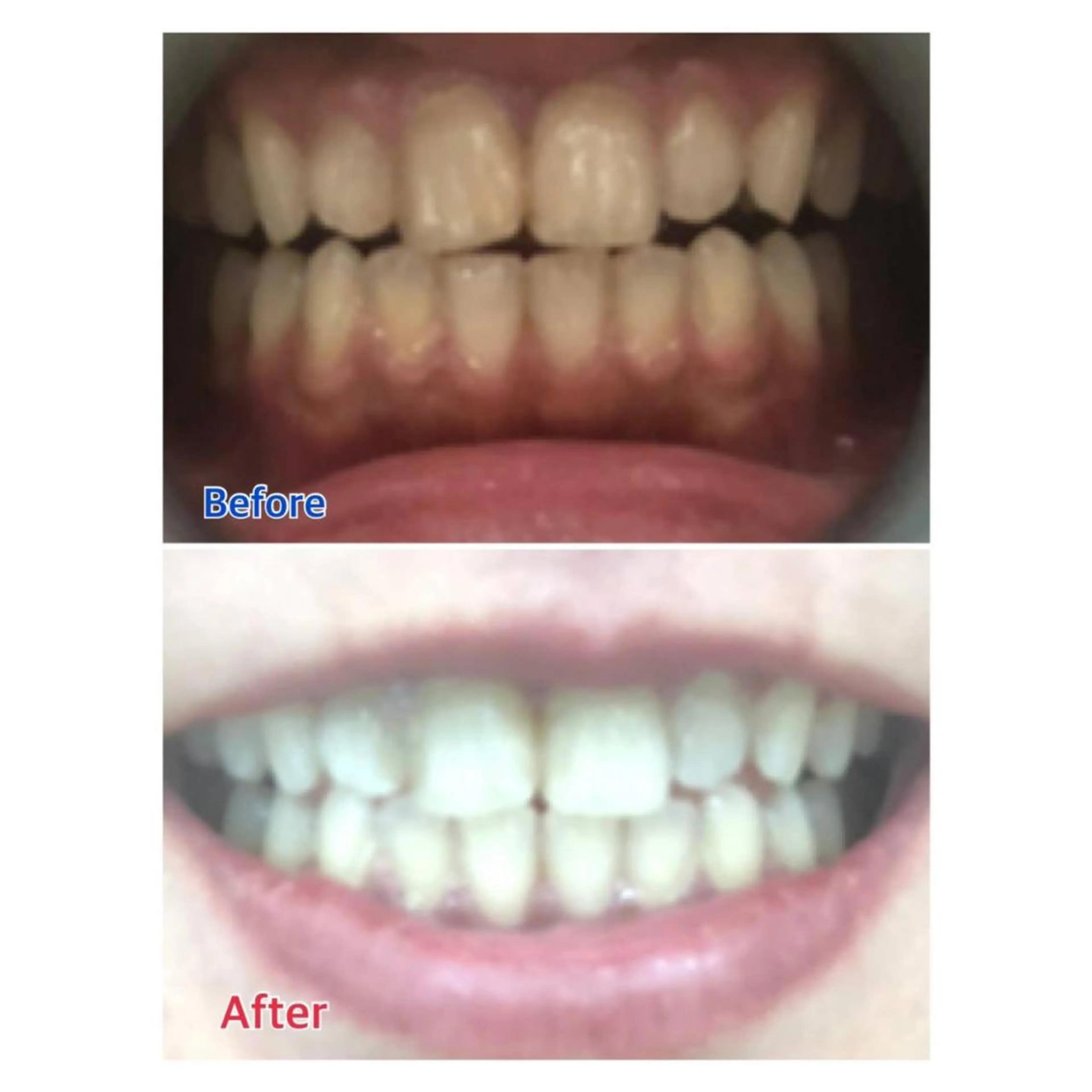 MBEAUTYSALON 千葉店・京成大久保所属・Melty 輝のその他イメージ