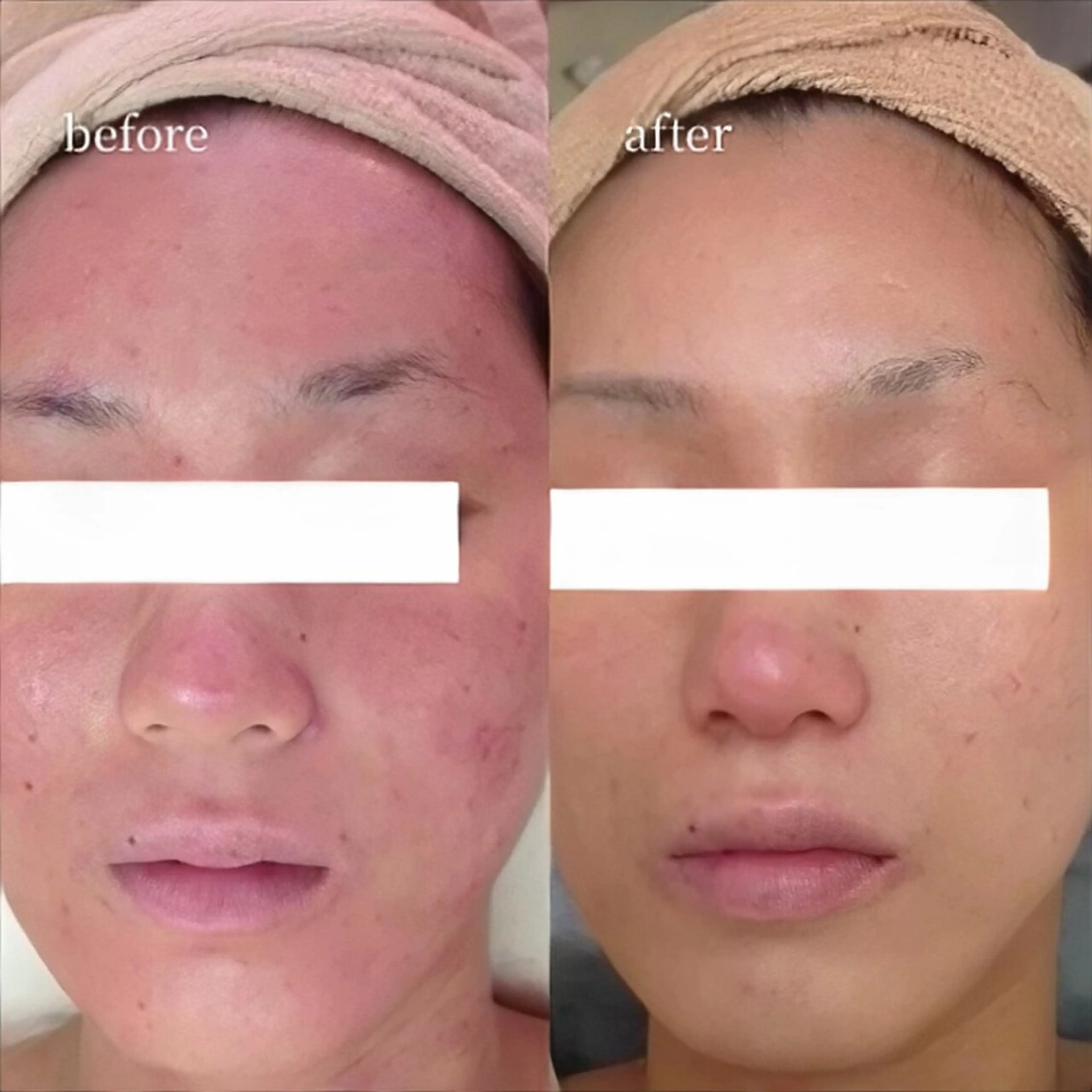 韓国肌管理・肌質改善 EARNEST心斎橋のエステ・リラクイメージ