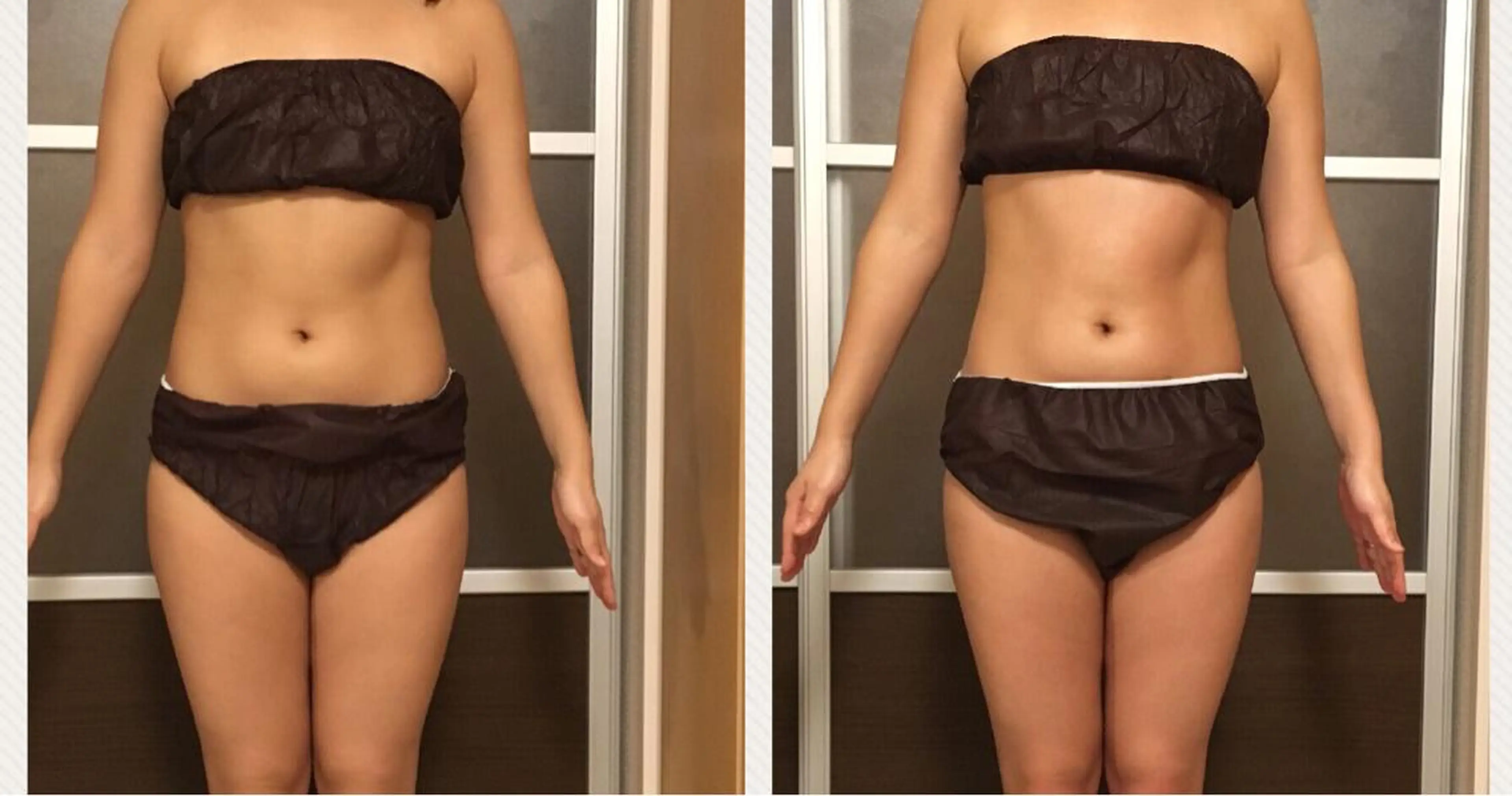 ショート カラー パーマ ヘアアレンジ メンズ キッズ ネイル マツエク・マツパ アニメ,Vオタク× 即効痩せエステサロンのエステ・リラクイメージ