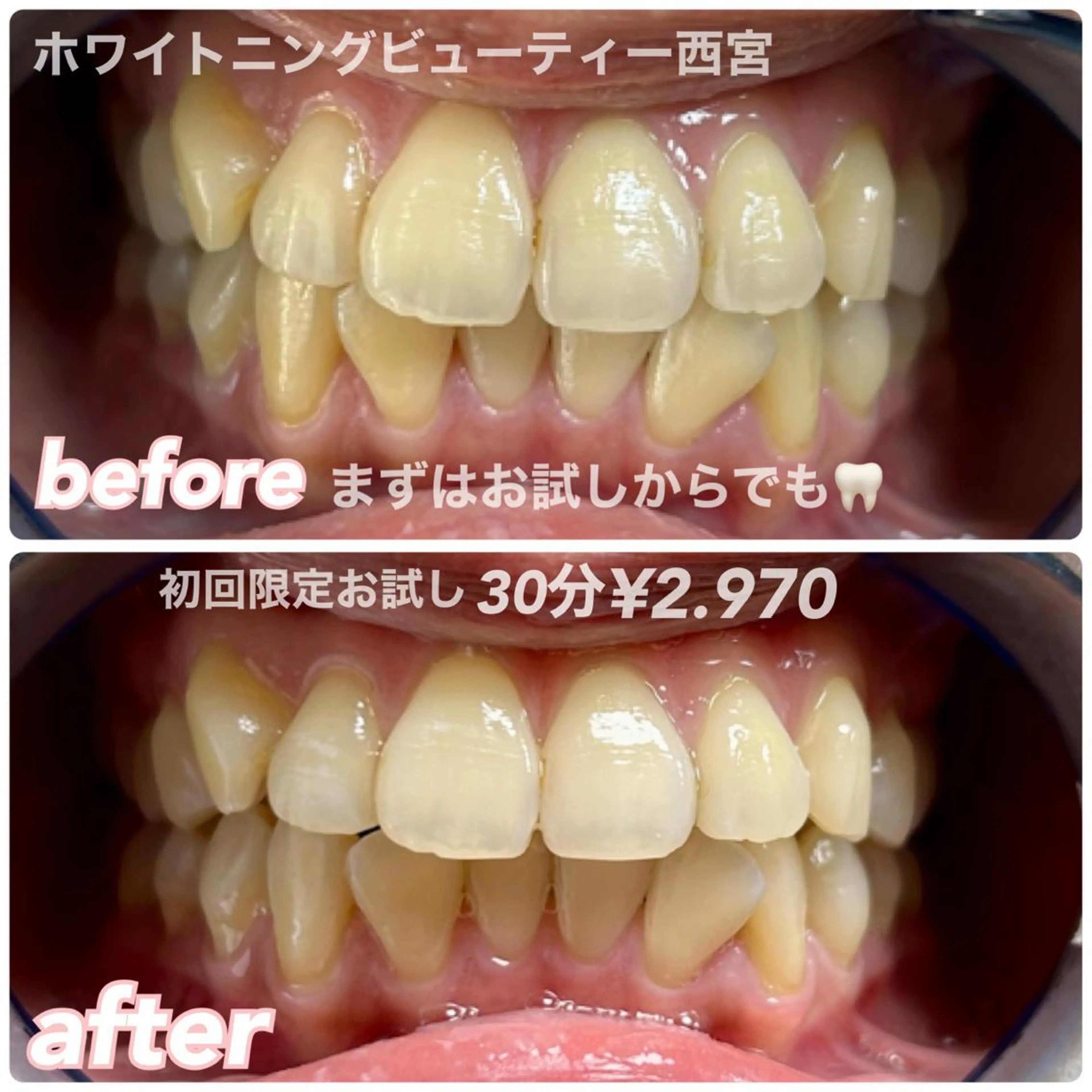ホワイトニングビューティー西宮店所属・ホワイトニングビュー ティー西宮店のその他イメージ