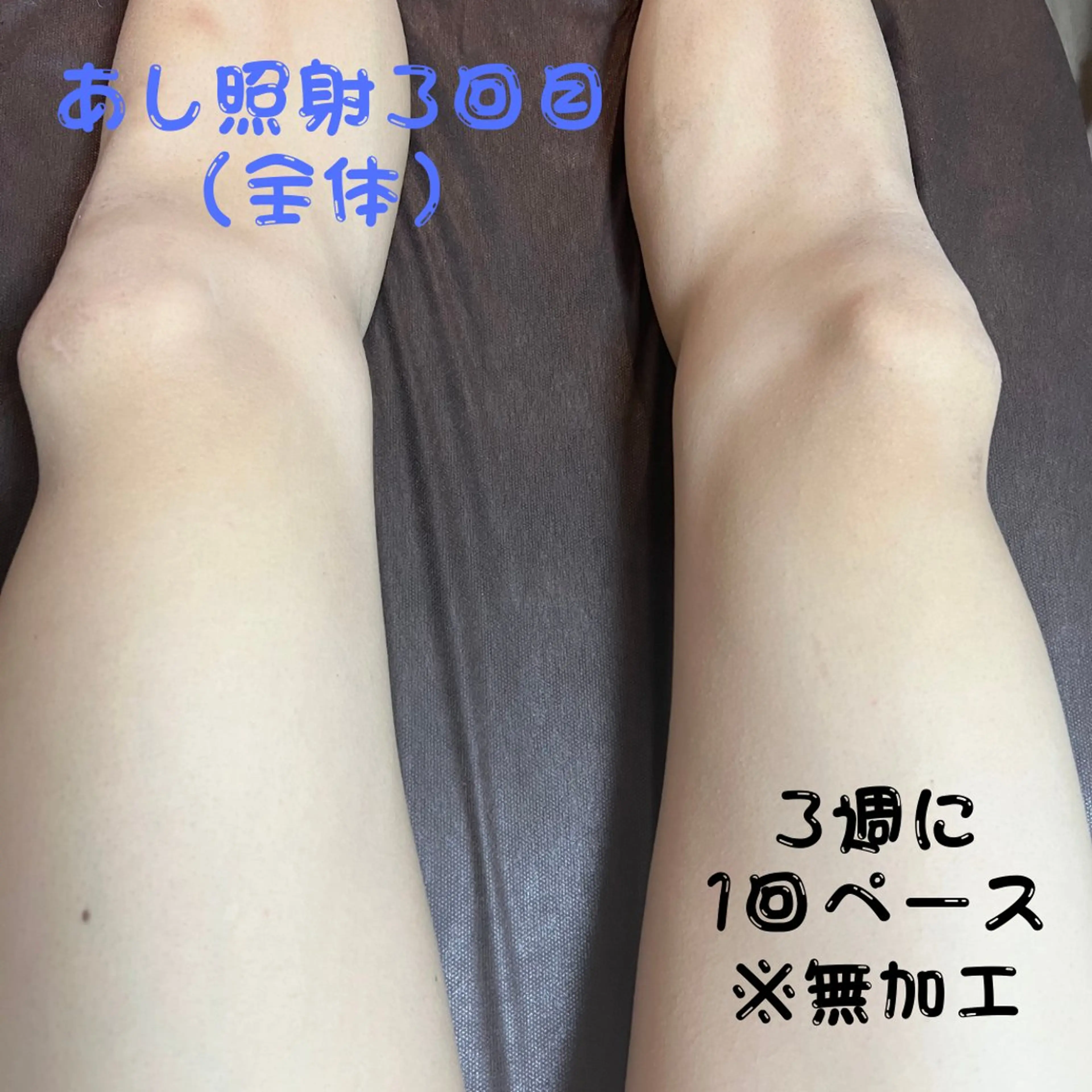 メンズ キッズ 脱毛 メンズ脱毛フェリッセ /男女🆗キッズ🆗のエステ・リラクイメージ