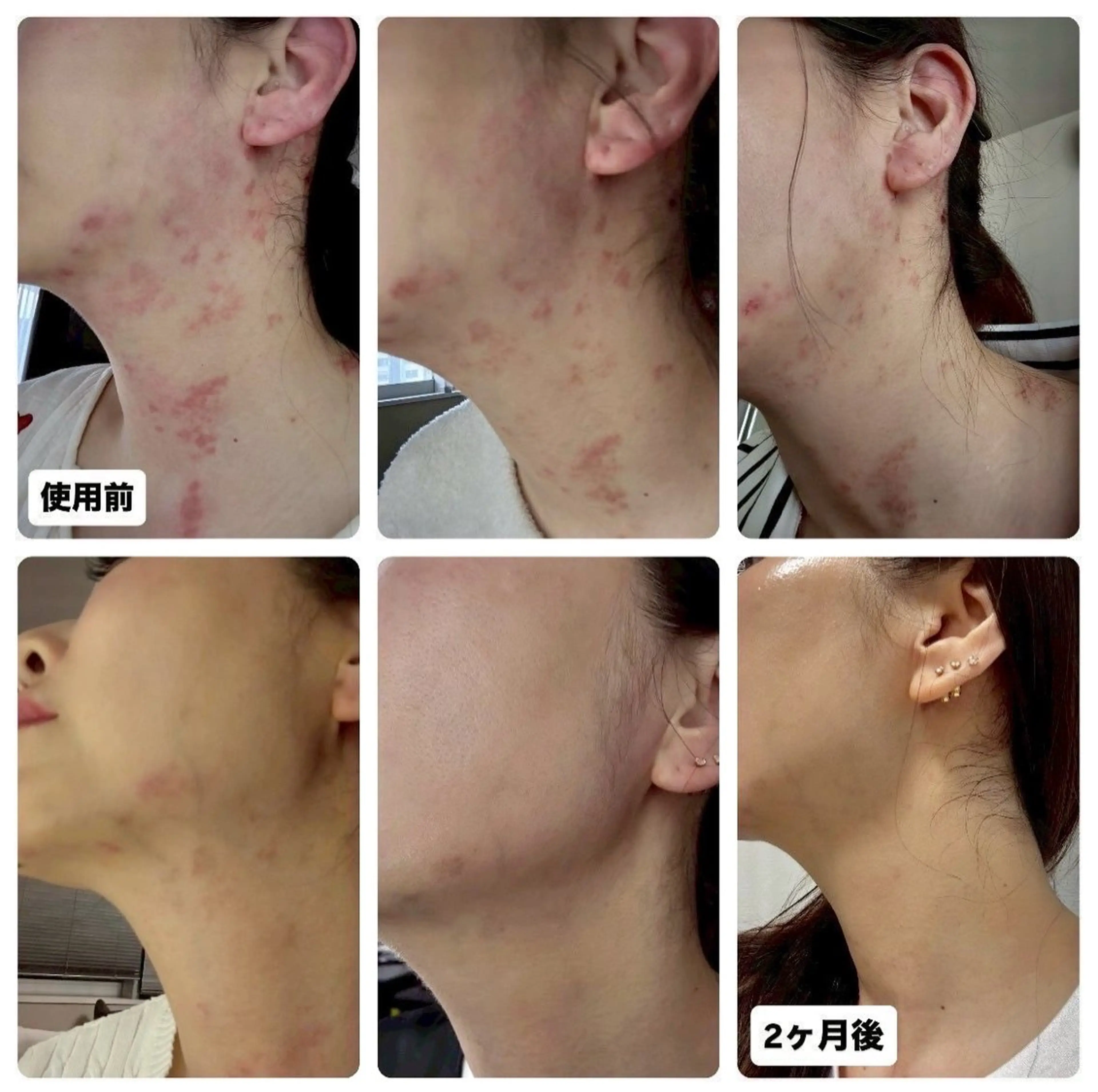 エステ エンダモロジー BINOSUのエステ・リラクイメージ