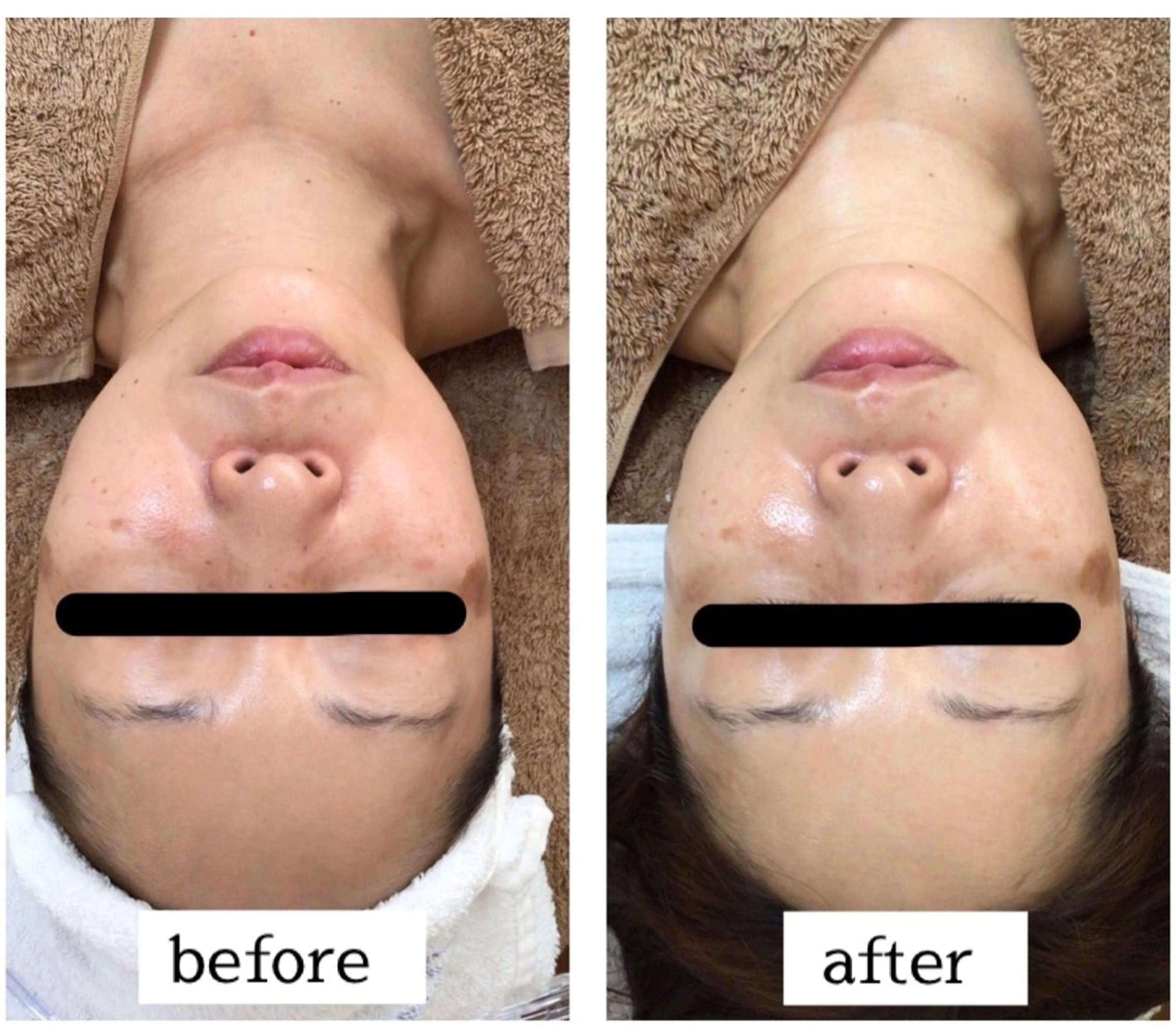 肌悩み改善 〜エステサロン〜のエステ・リラクイメージ