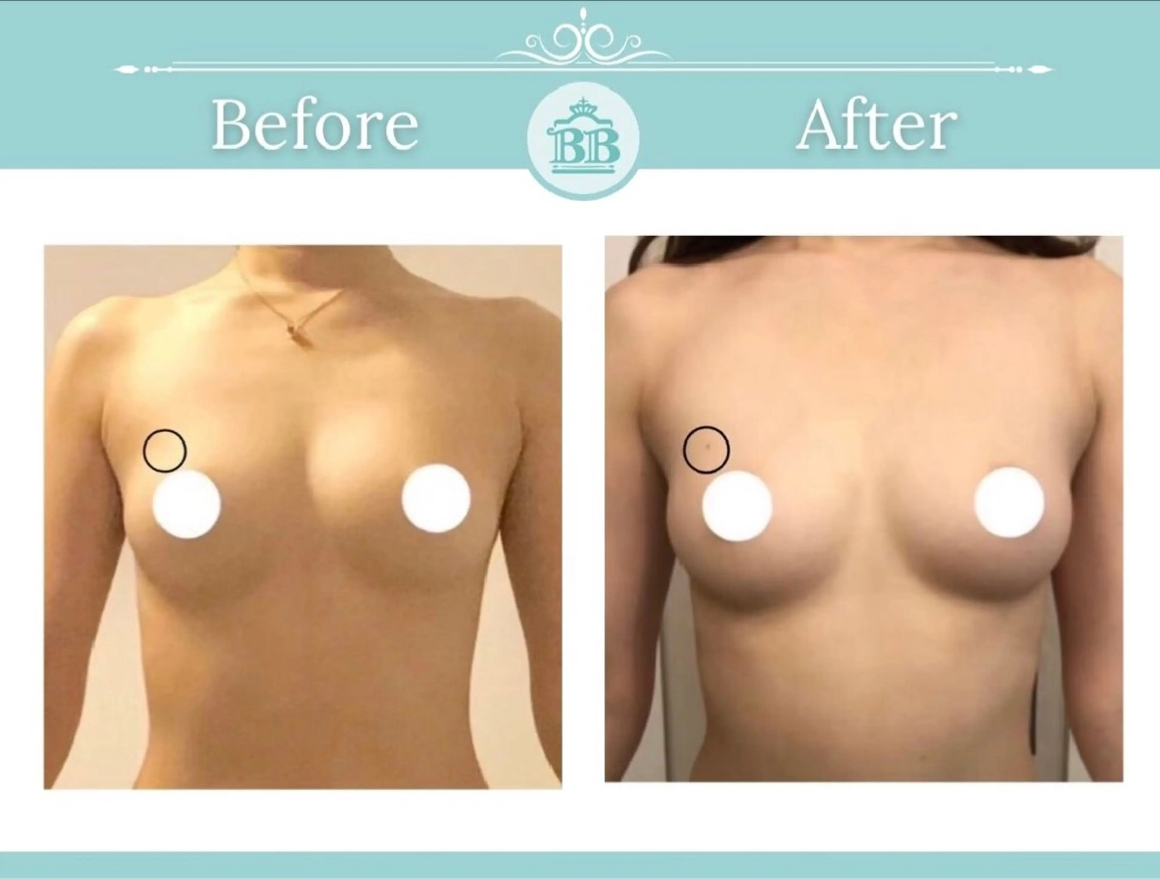 エステ 美人バスト 本厚木店のエステ・リラクイメージ