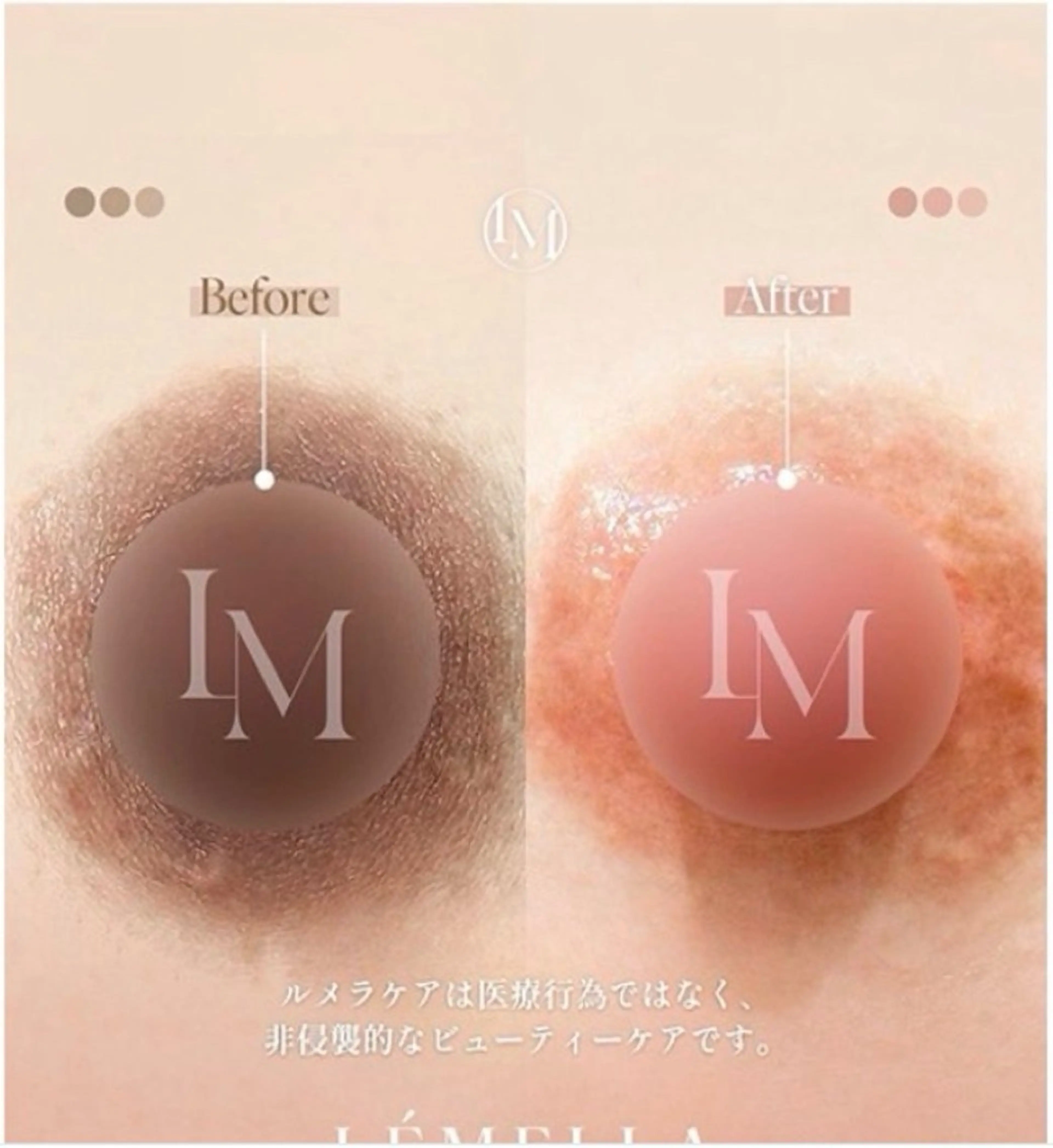 🆓【TikTok・Instagramで話題のルメラ🌿】育乳マッサージ付きの写真