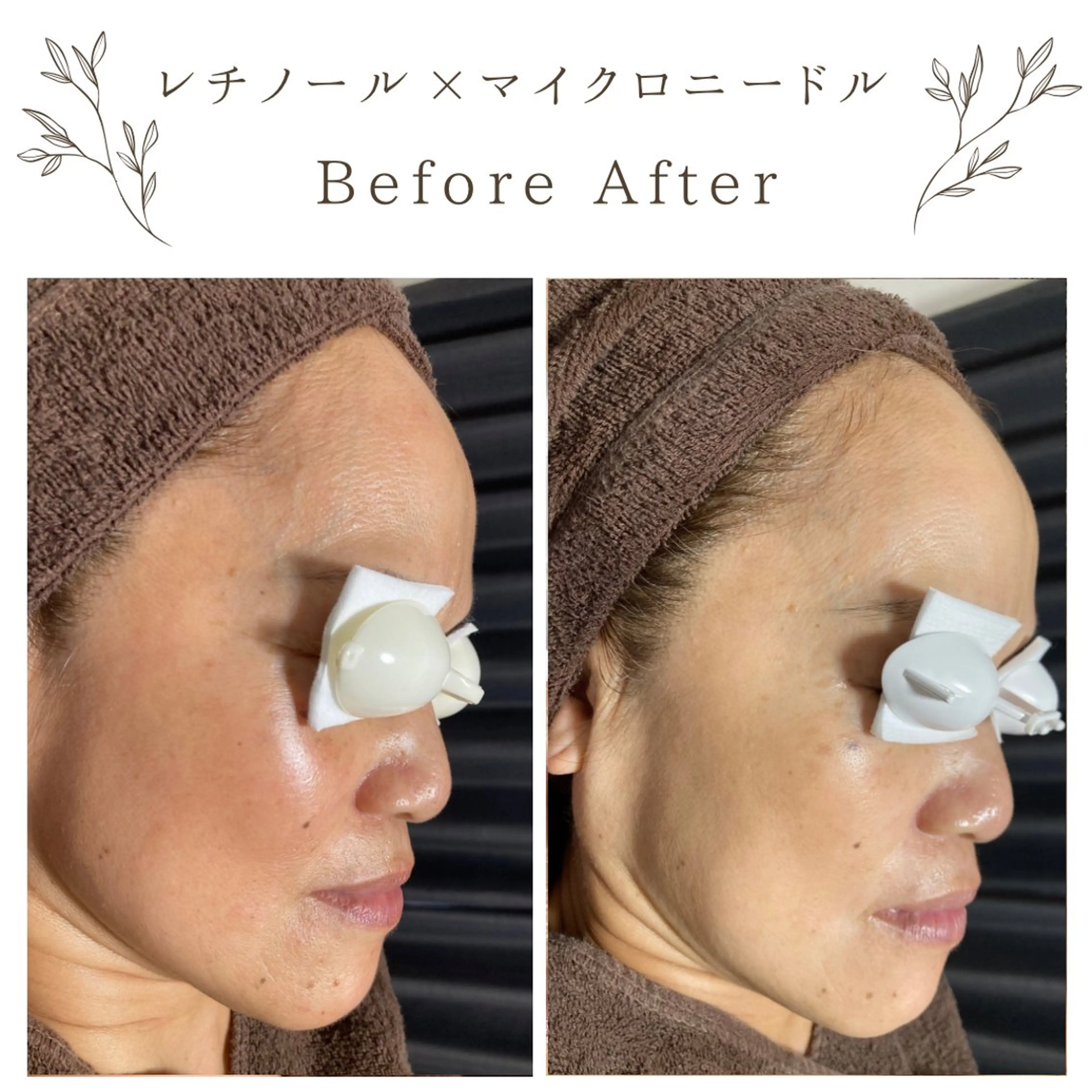 な ぎのエステ・リラクイメージ