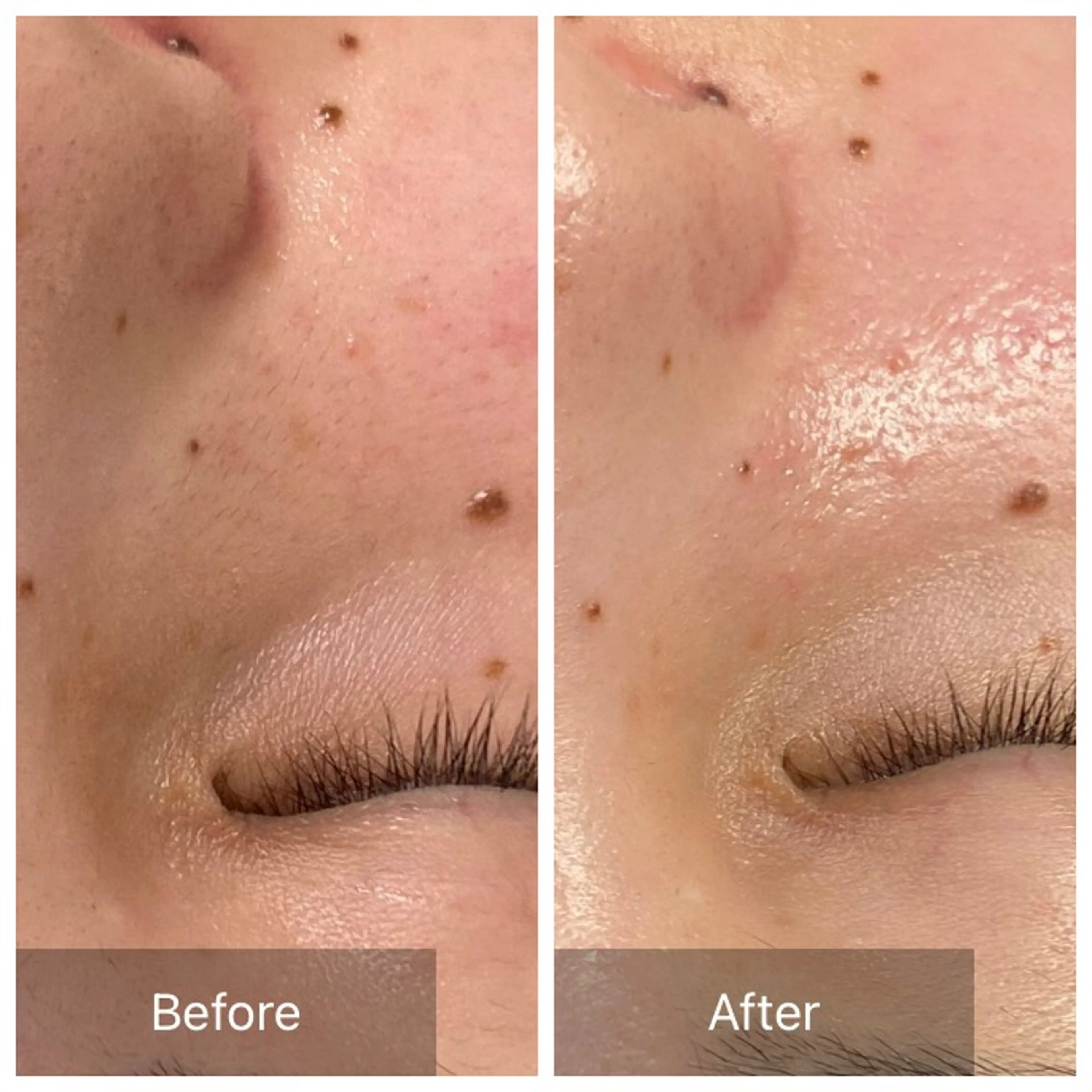 脱毛 産毛専門店 Bittoのエステ・リラクイメージ