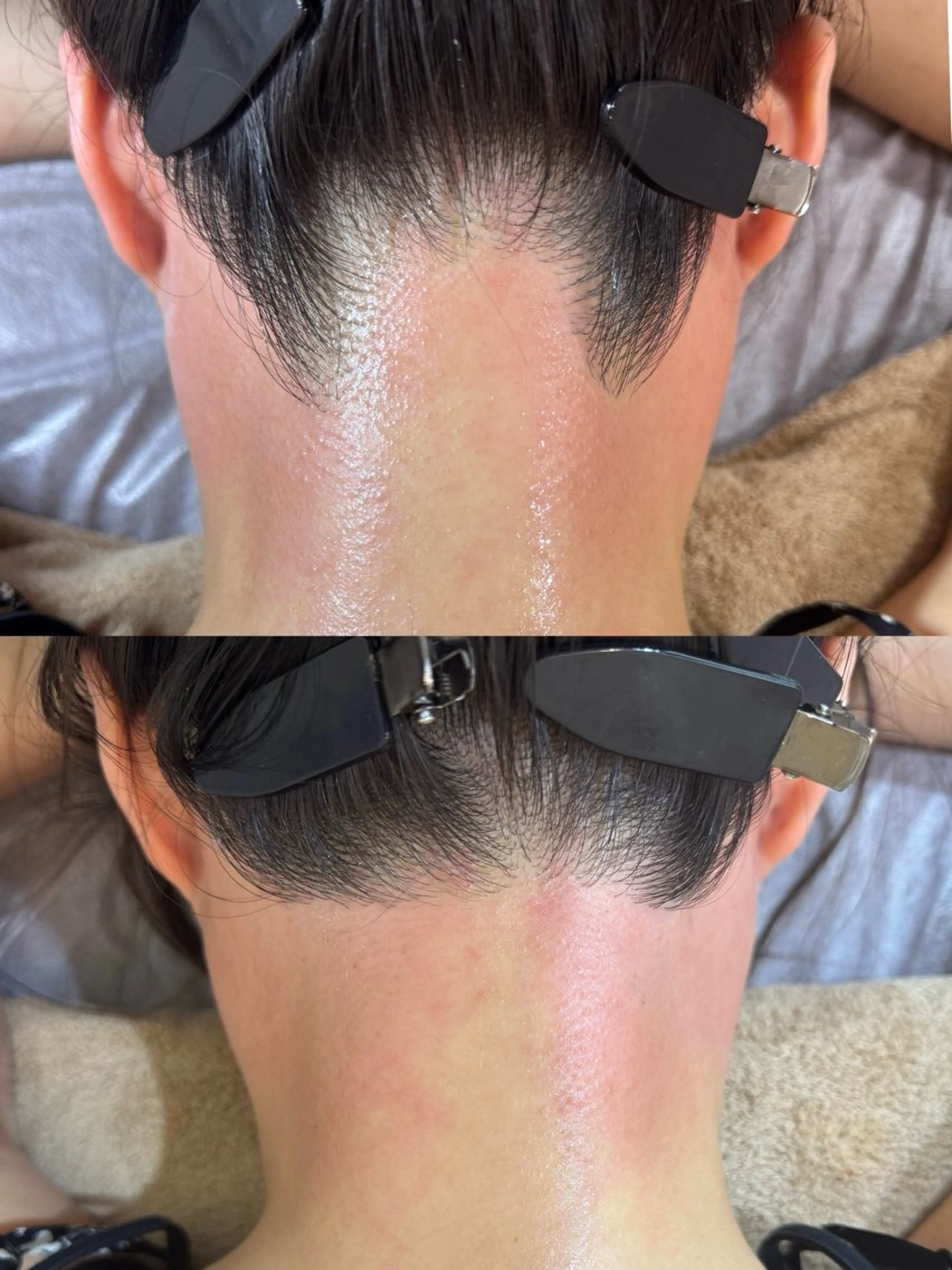 脱毛 AngelWax【エンジェルワックス】新宿店所属・ワックス脱毛/光脱毛 🎀新宿駅徒歩5分のエステ・リラクイメージ