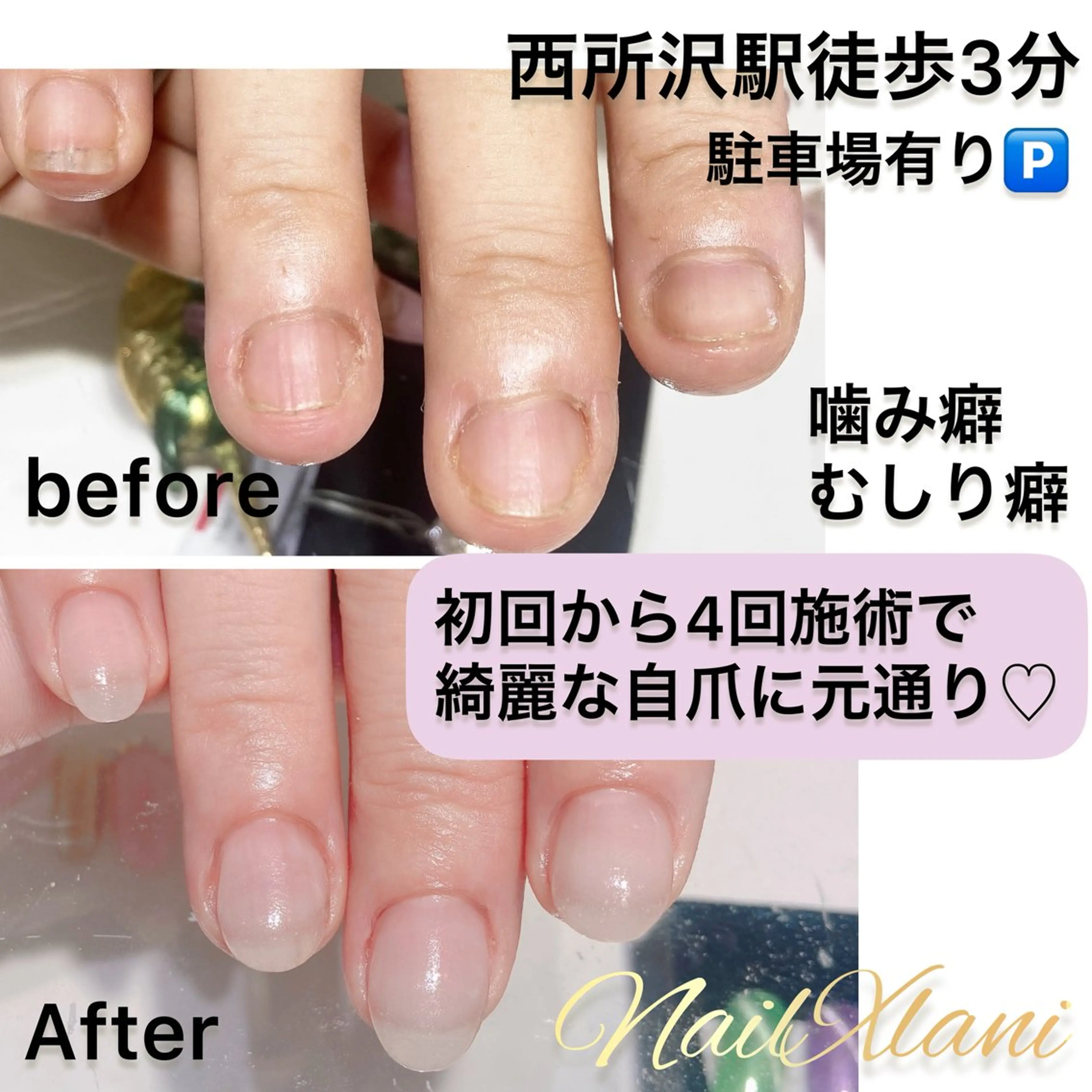ネイル フットネイル ジェルネイル マグネットネイル パラジェル ハンドネイル Nail×Lani 深爪矯正対応◎のネイルデザイン