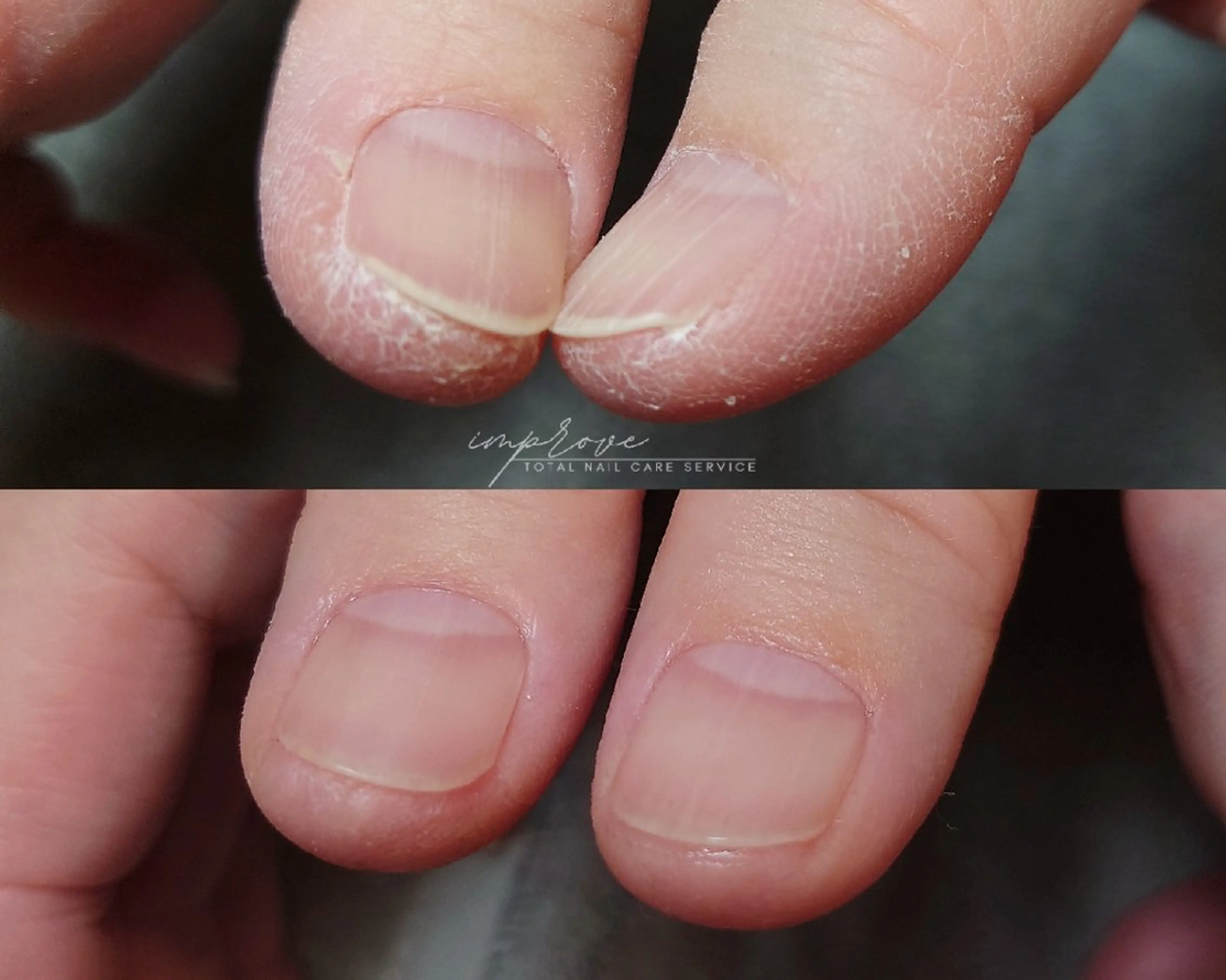 ネイル improve /mamiのネイルデザイン