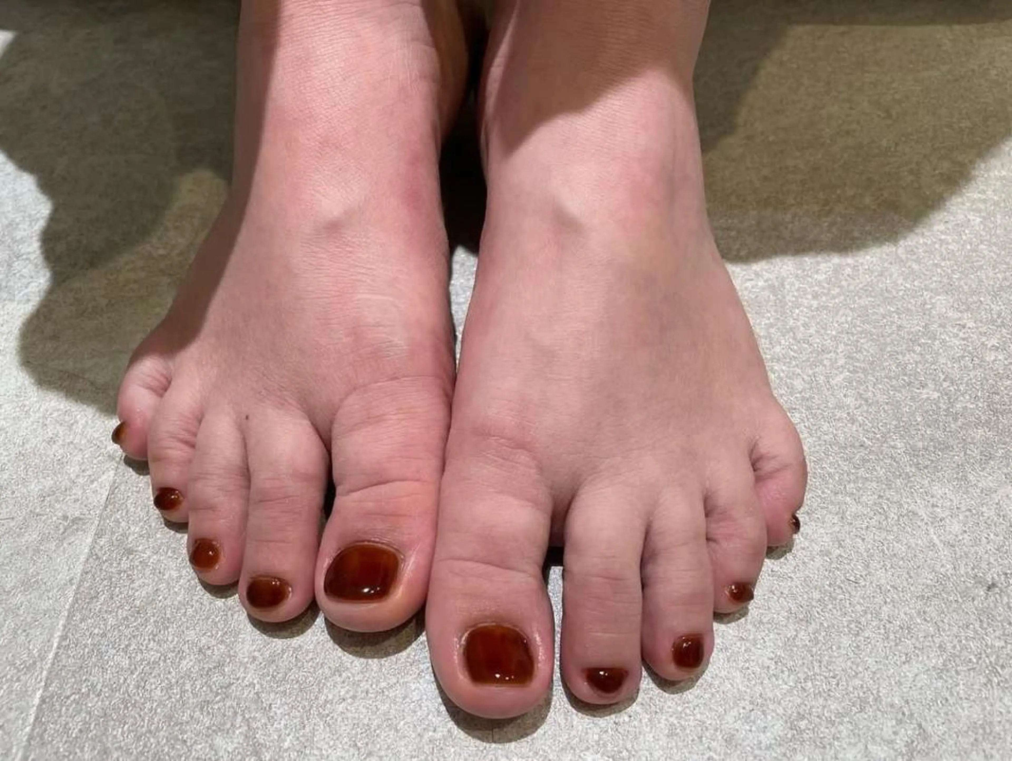 ネイル aloalo MIKAのネイルデザイン