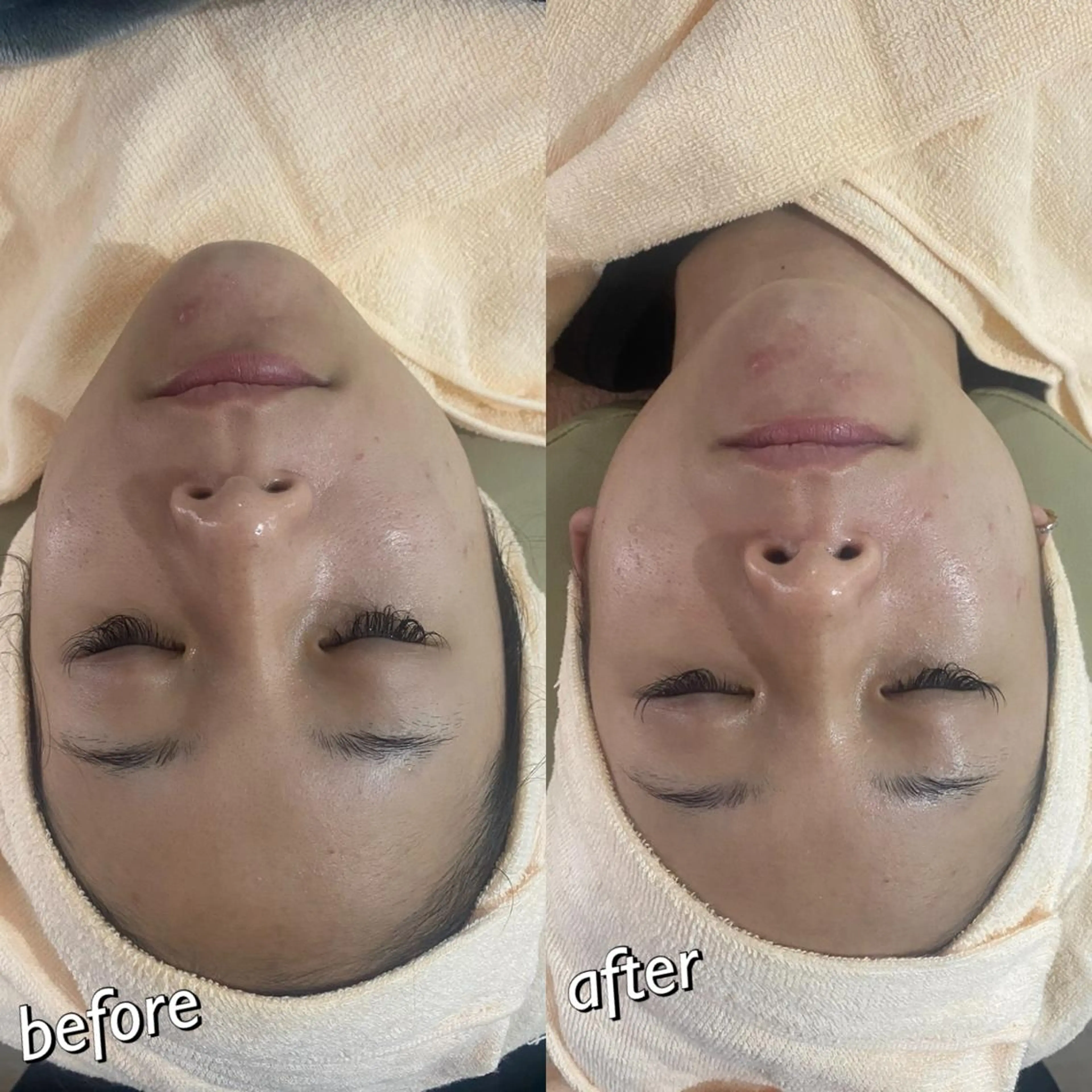 うなじ脱毛/美肌脱毛 LABELのエステ・リラクイメージ