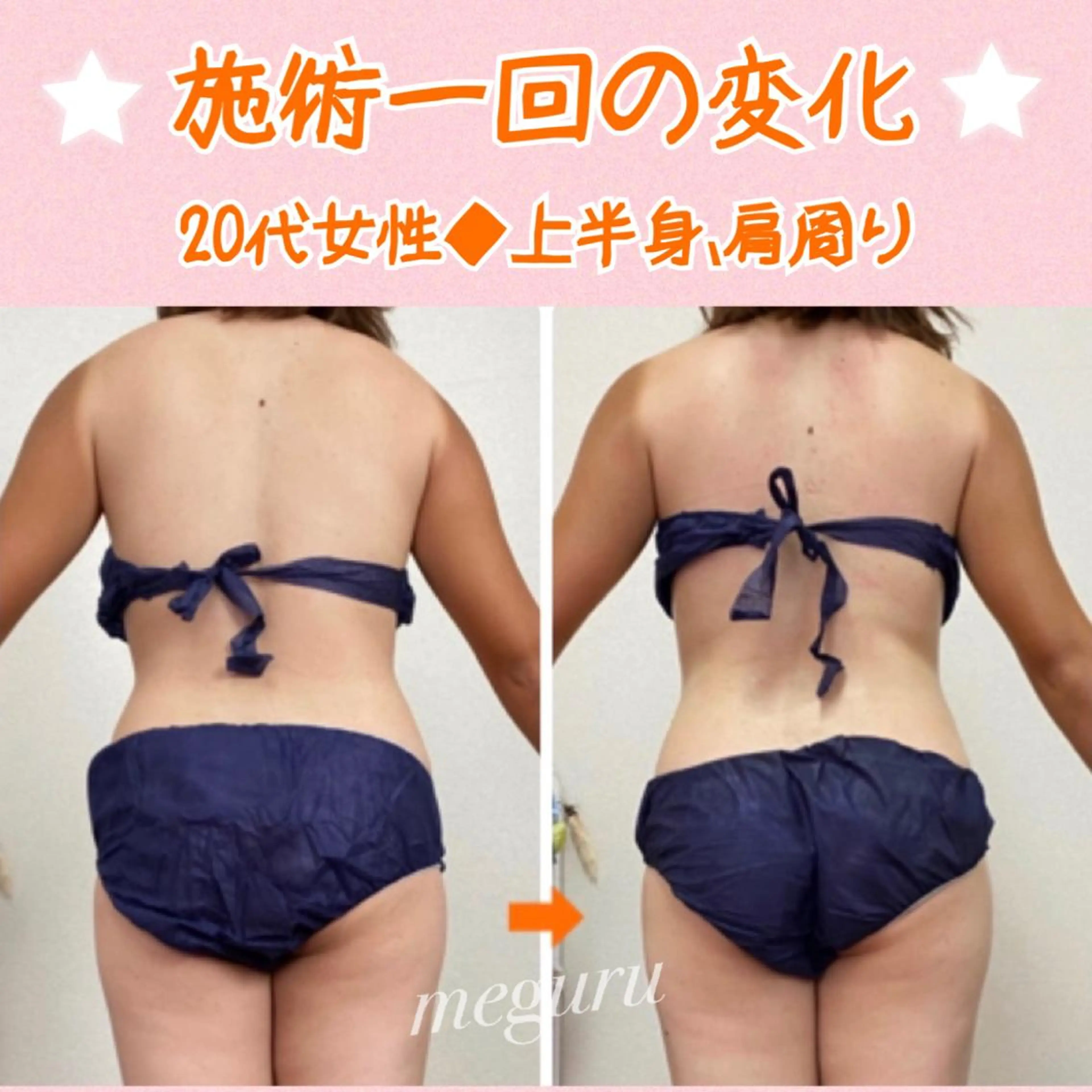 ショート カラー パーマ ヘアアレンジ メンズ キッズ ネイル マツエク・マツパ エステ リラク ‍痩身＆ボディ 結果出し🌟丹野のエステ・リラクイメージ