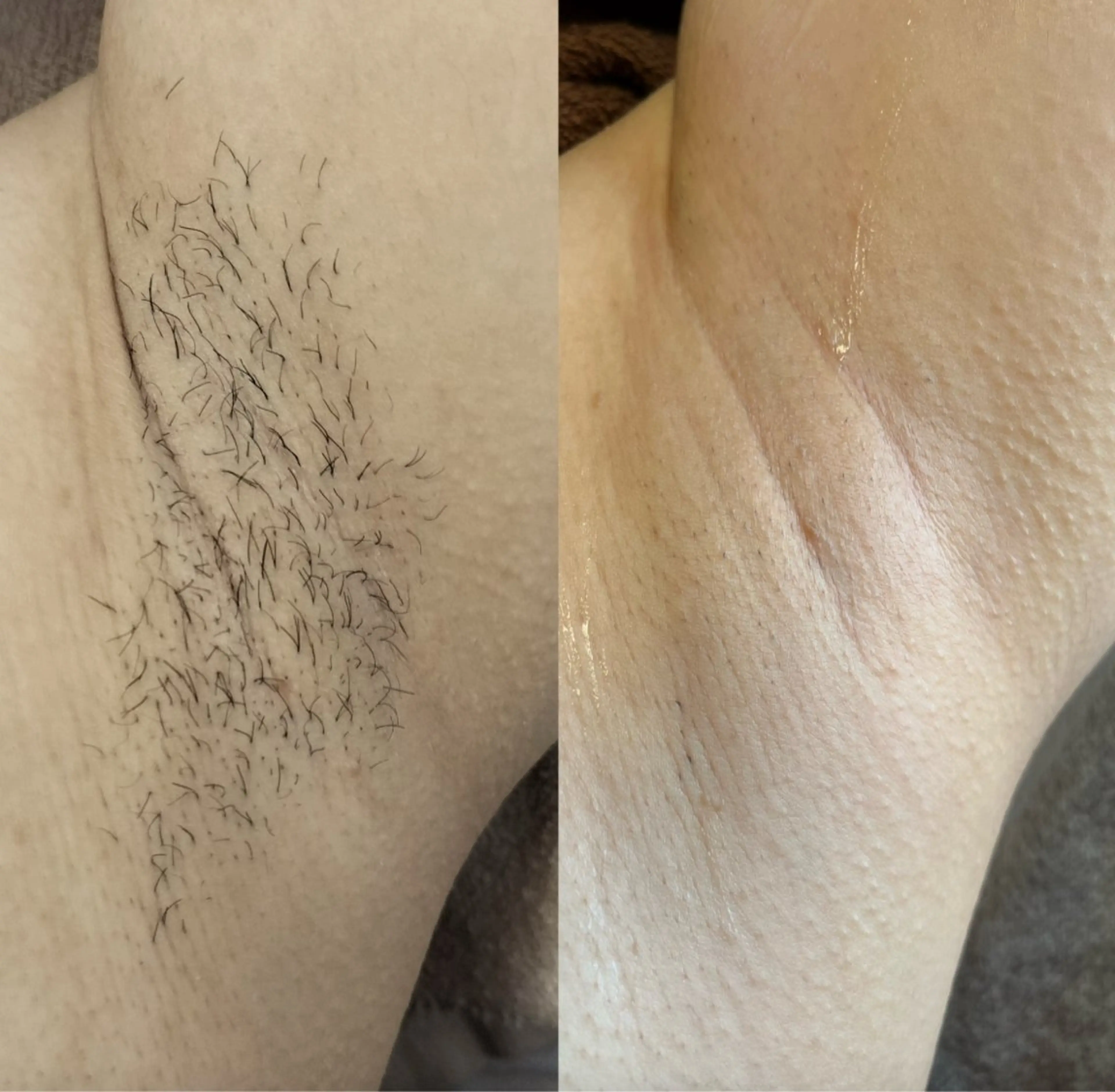 脱毛 Momo.所属・相模大野のサロン🌿 Momo.のエステ・リラクイメージ