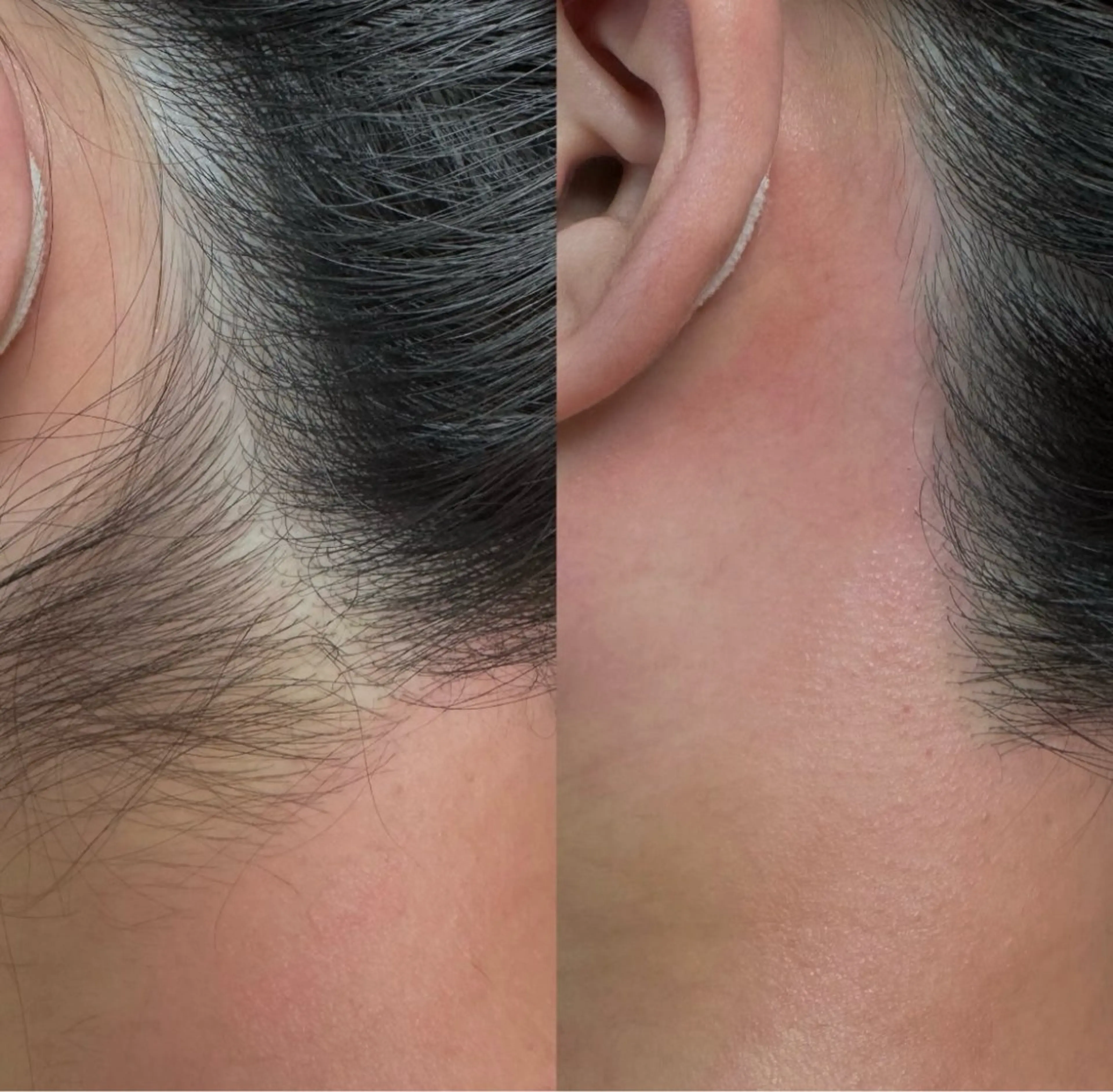 脱毛 smoky bee｜ HBL/似合わせ眉の眉毛・アイブロウイメージ