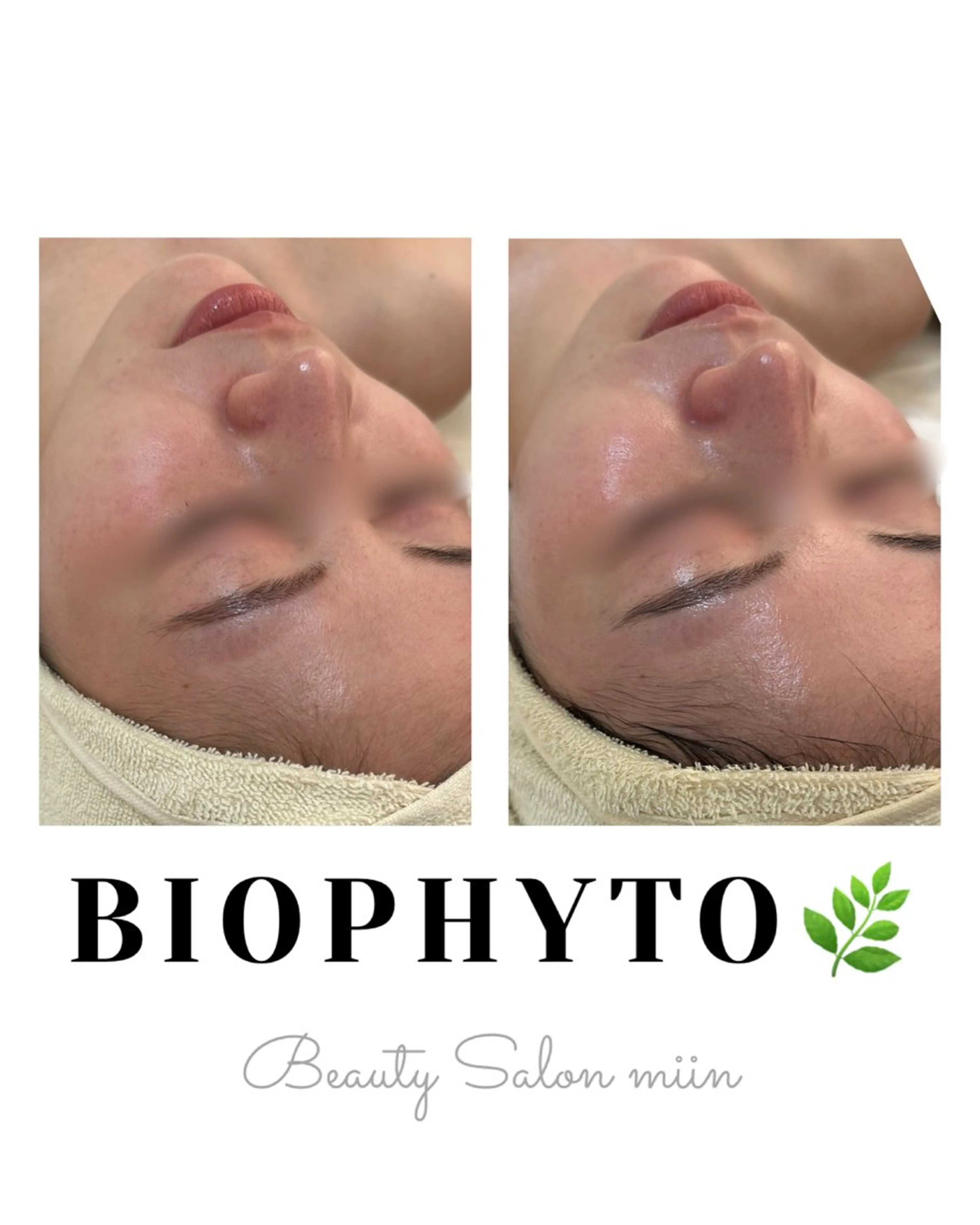 エステ 韓国肌管理 白玉肌管理®︎のエステ・リラクイメージ