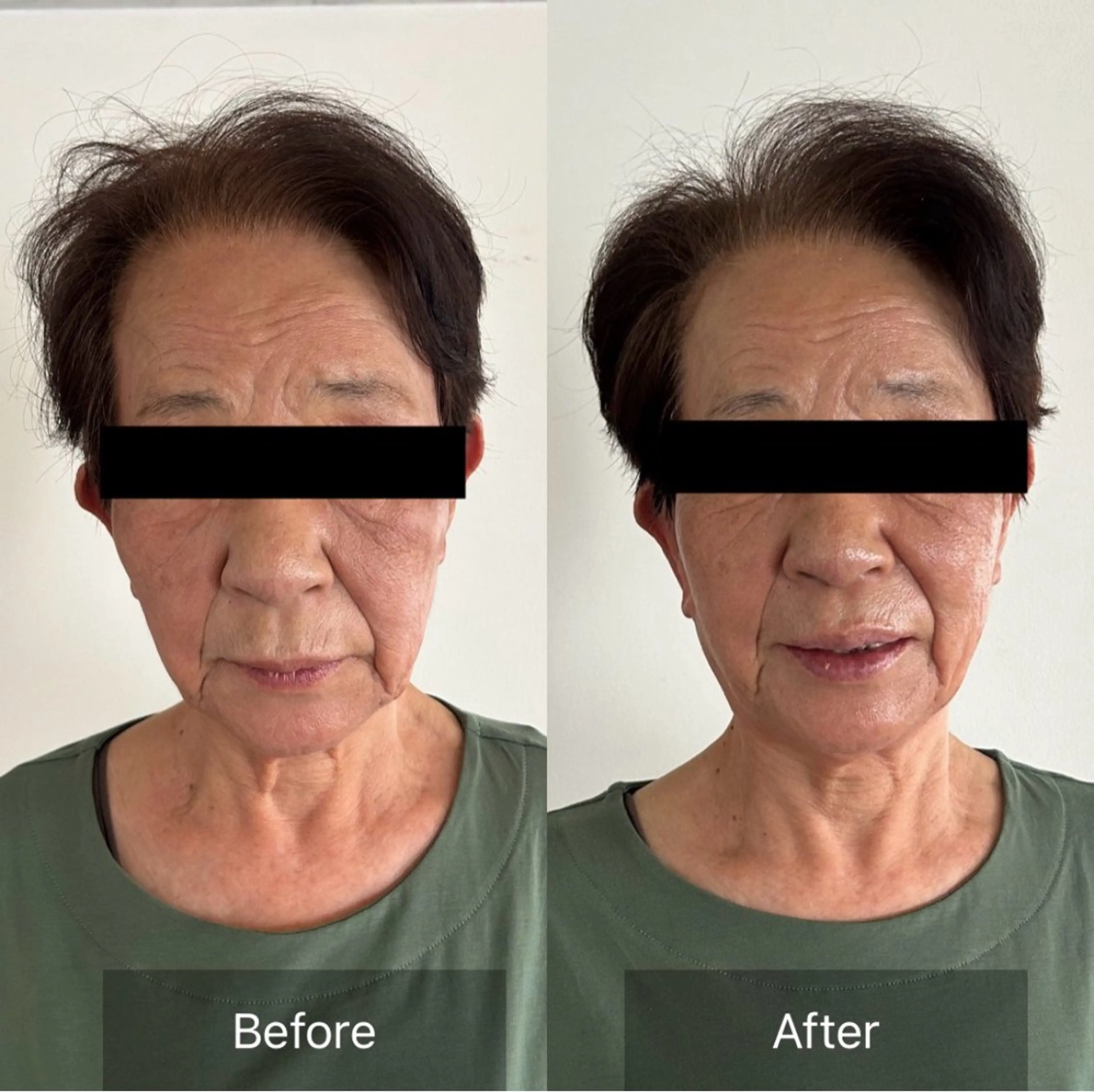 Radiance H.Oのエステ・リラクイメージ