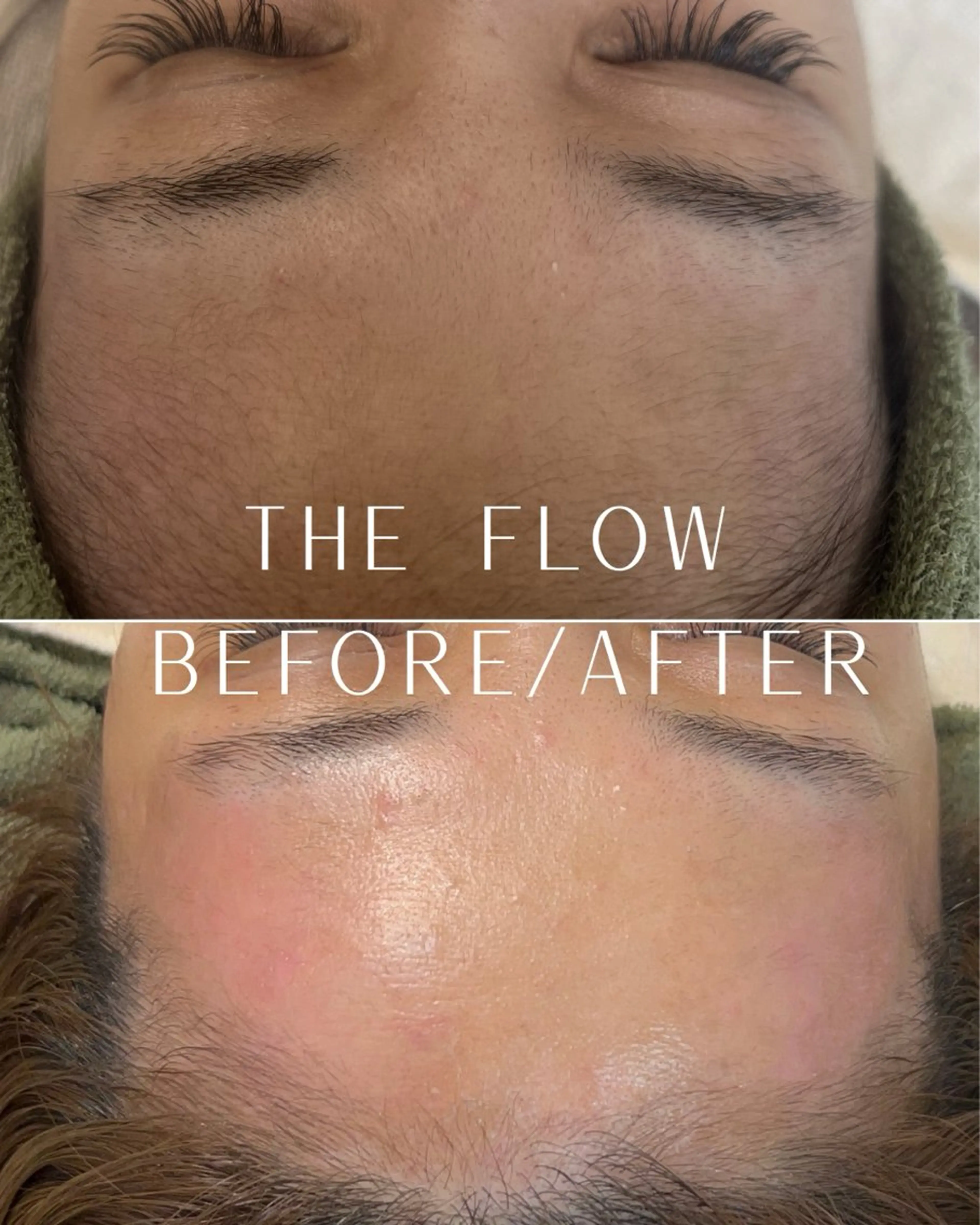 アイブロウ ワックス脱毛 眉カット その他(アイブロウ) 稲垣 優のエステ・リラクイメージ