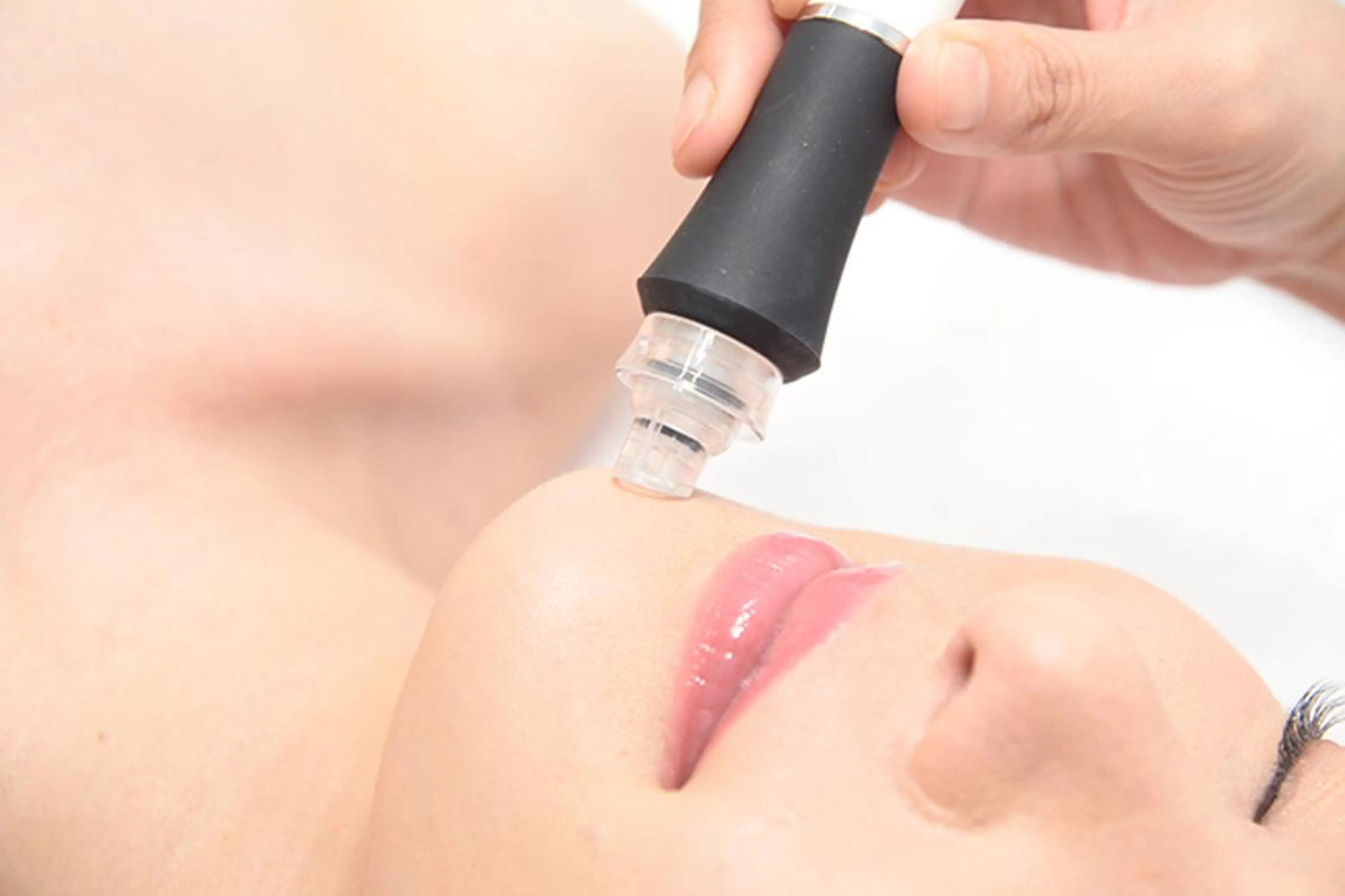 《全顔》ハイドラ🩵お肌のごわつき/ざらつき/毛穴の開き/が気になる方にオススメの写真