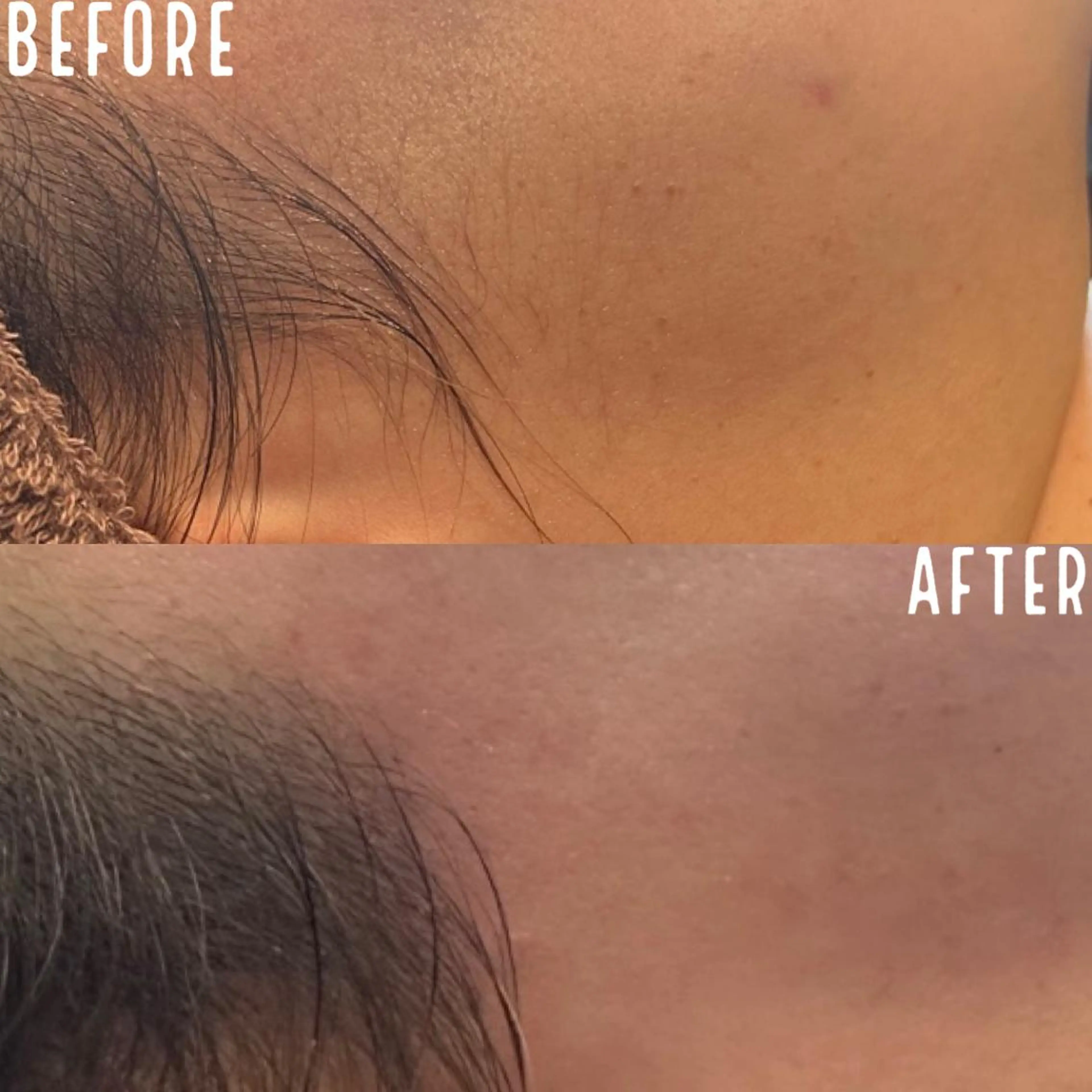 脱毛 KOHOLA -ワックス脱毛専門-のエステ・リラクイメージ