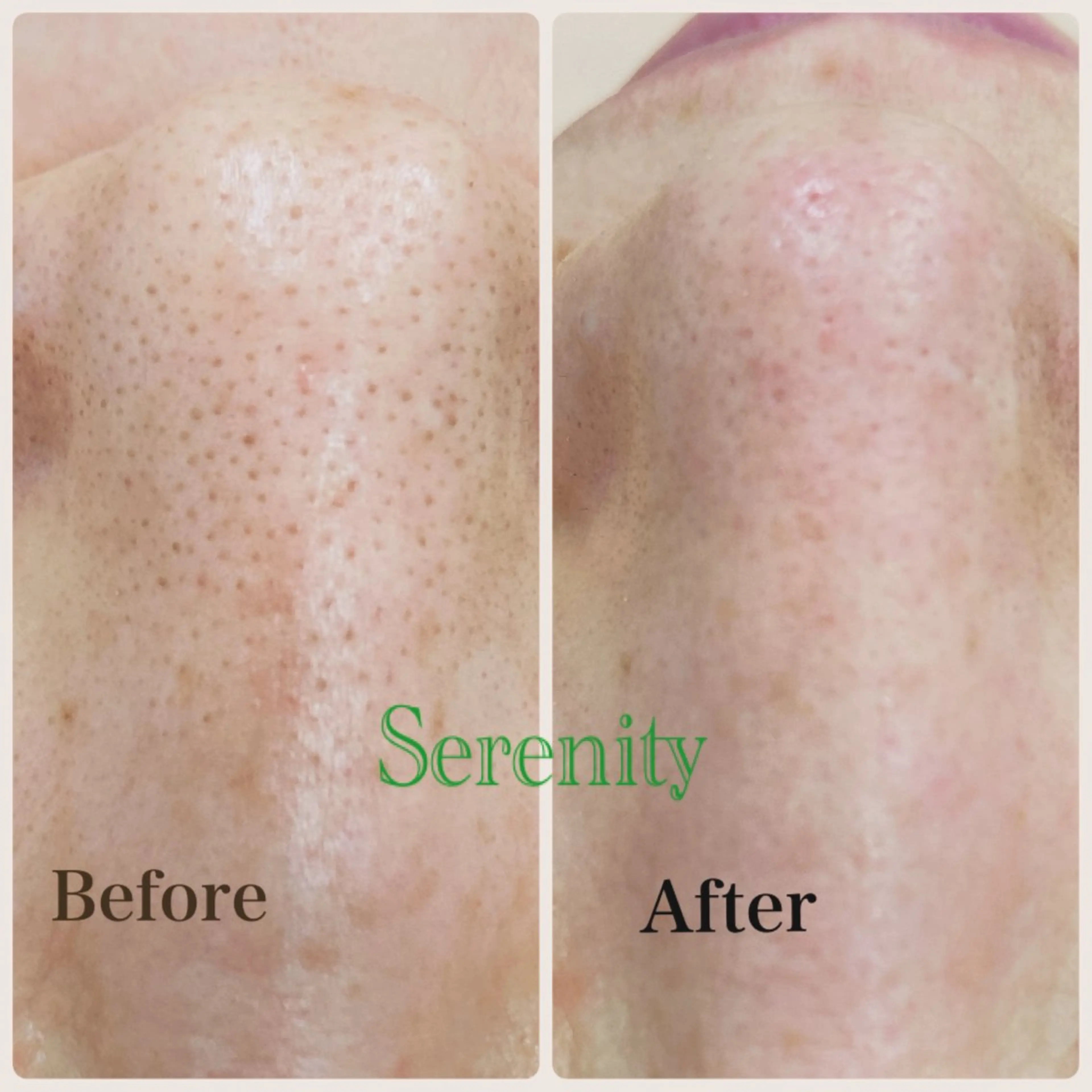 エステ エステセレニティー 山本美樹のエステ・リラクイメージ