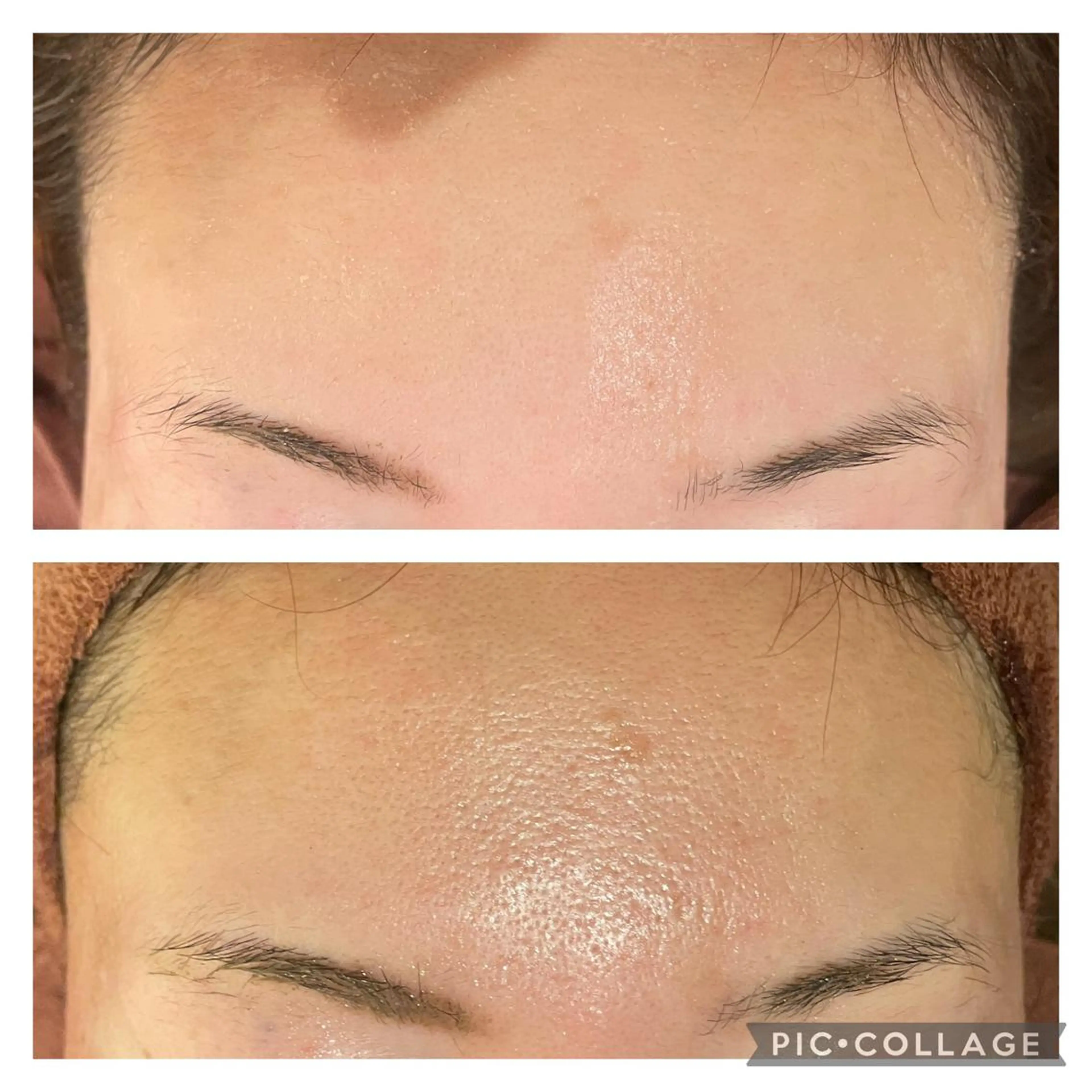 ミディアム カラー パーマ ヘアアレンジ メンズ キッズ ネイル マツエク・マツパ アイブロウ エステ リラク ニキビ特化型エステ 🍋最短で肌質改善のエステ・リラクイメージ