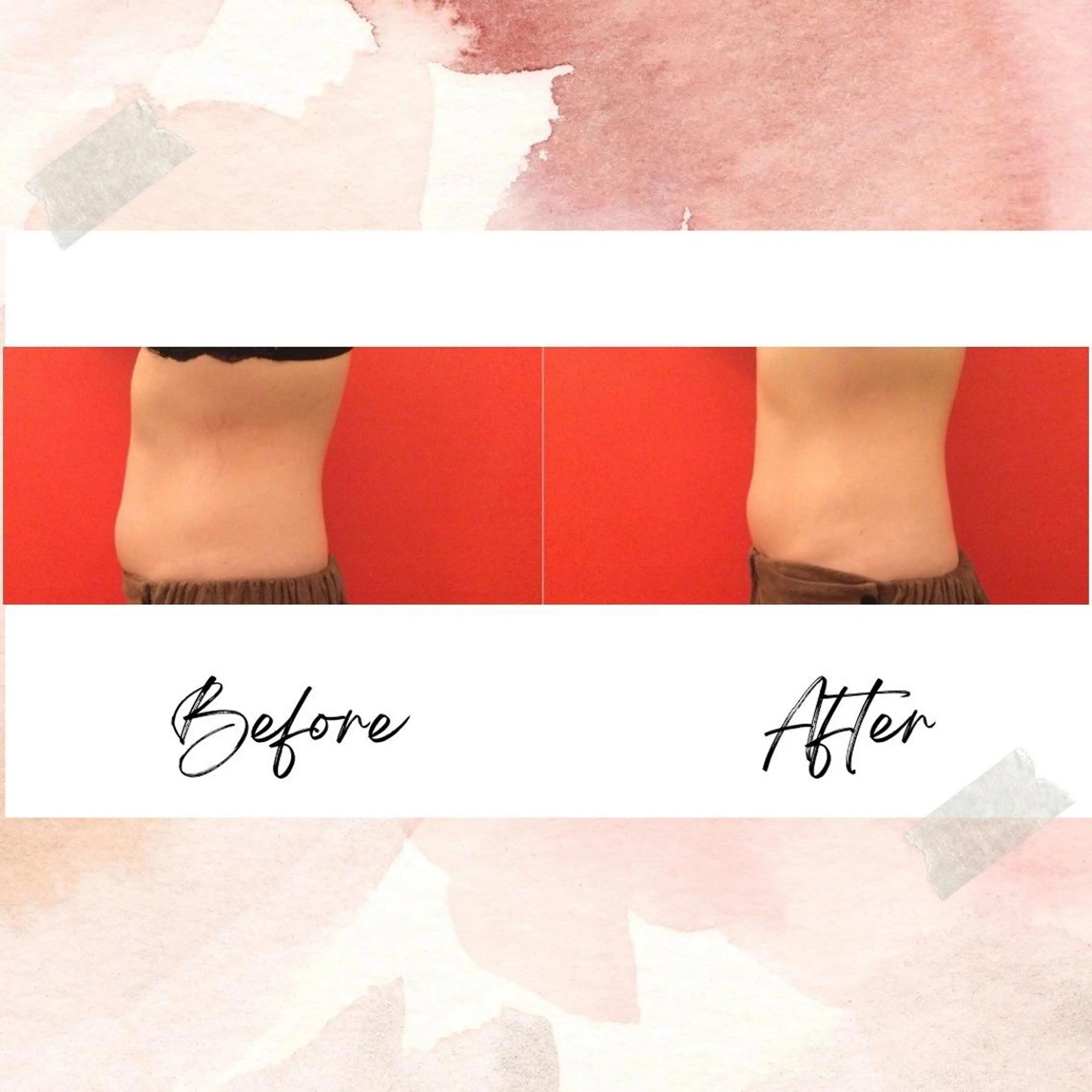 エステ リラク バスト・脱毛・痩身 上島のエステ・リラクイメージ