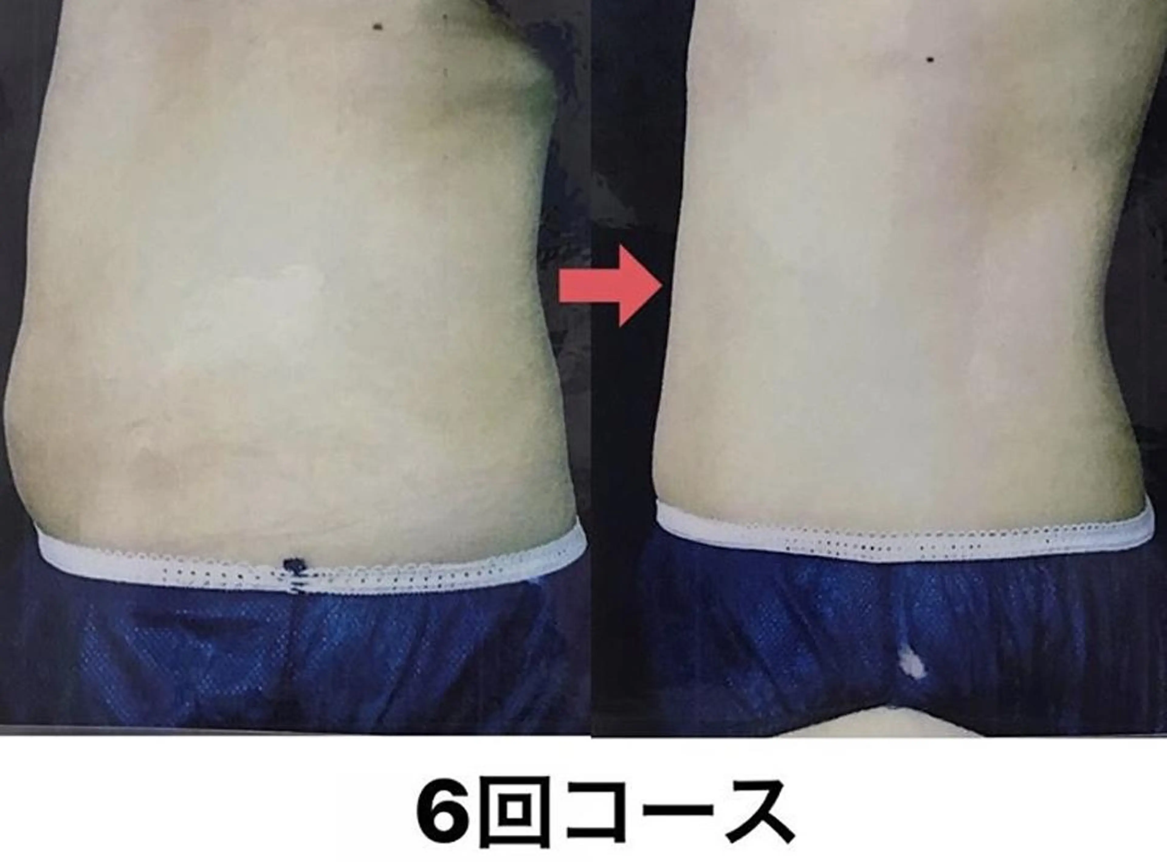 横浜エステサロン R-ing　リングのエステ・リラクイメージ