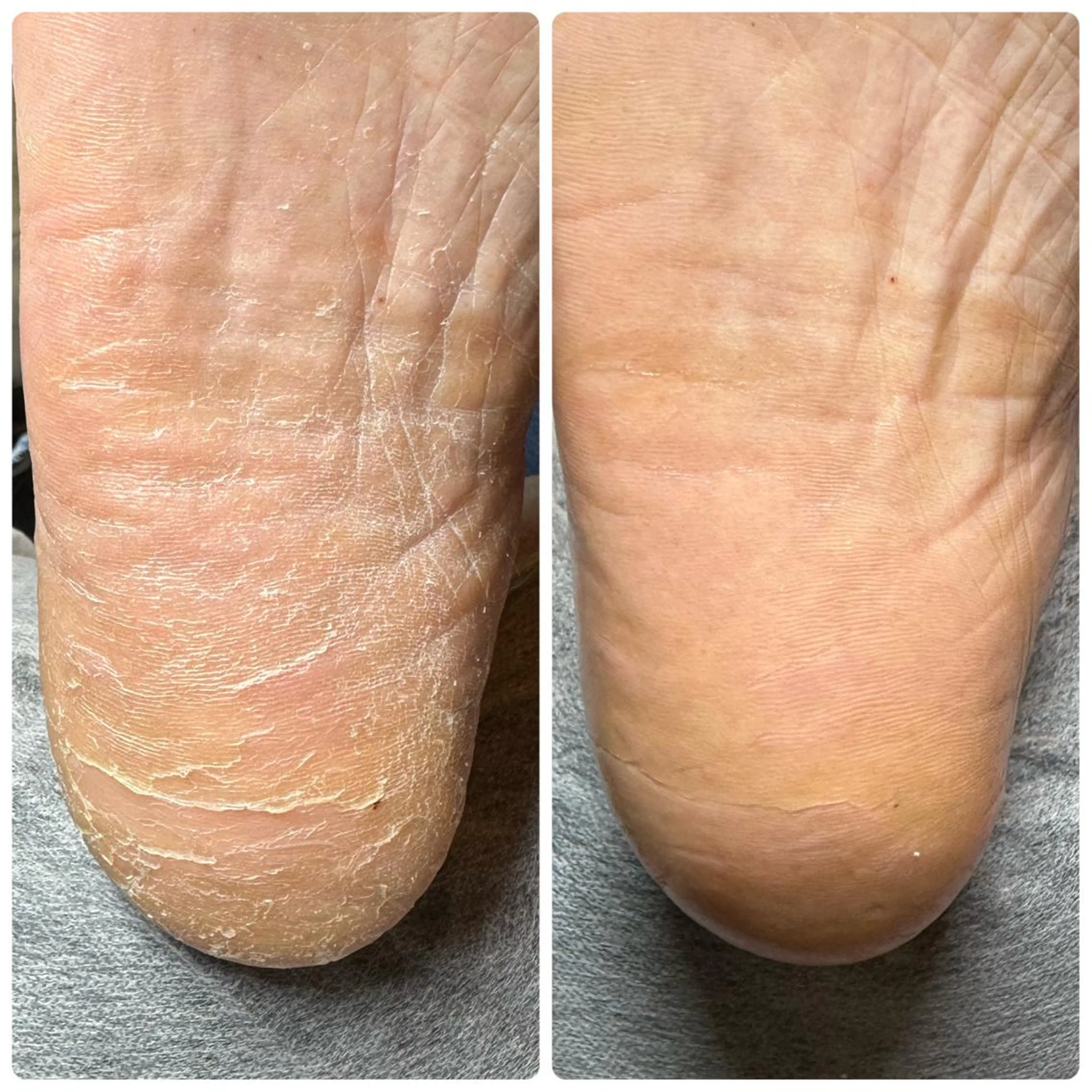 ネイル ROUN'　南 鈴沙のネイルデザイン