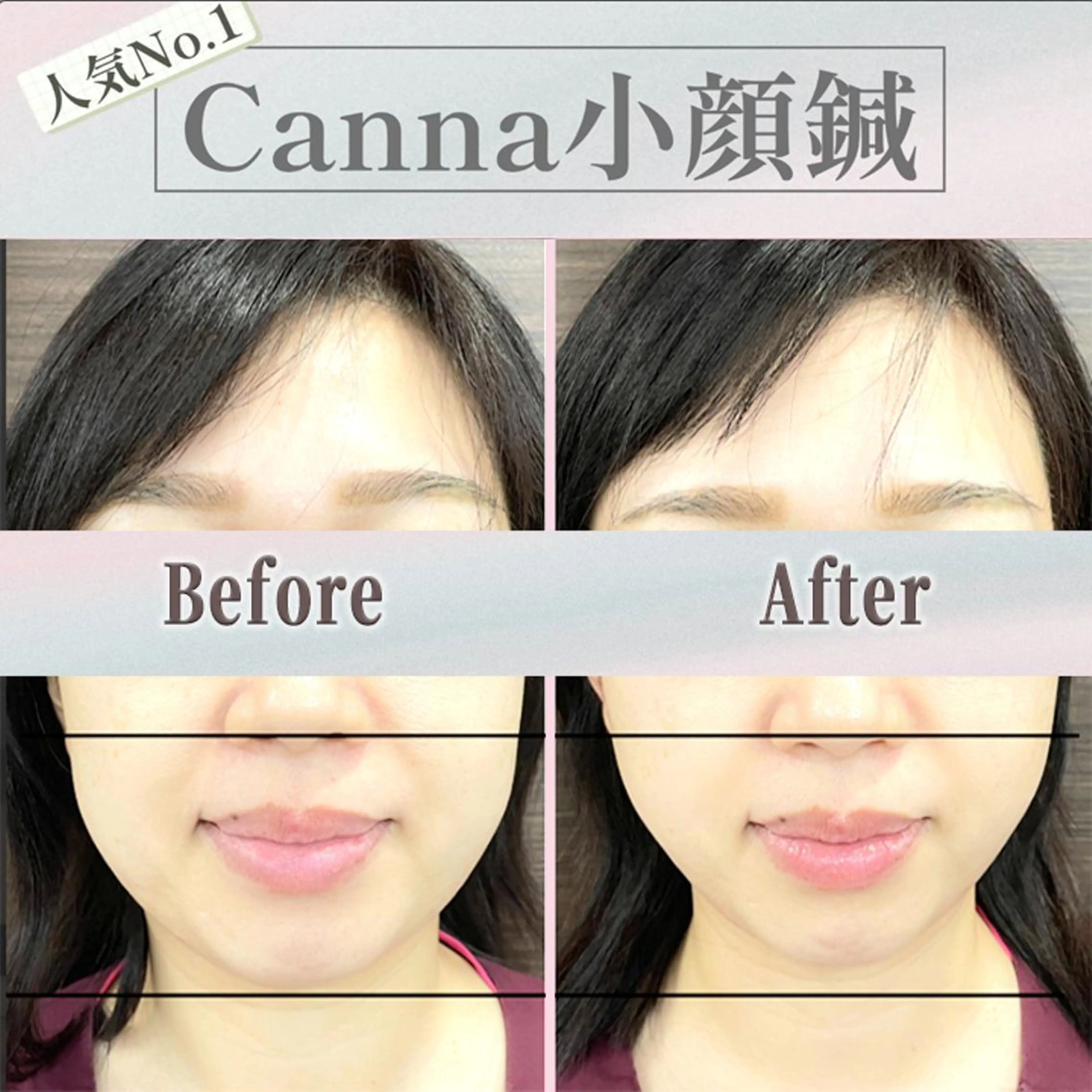 エステ リラク 【美容鍼・小顔鍼】 鍼灸師　森原拓磨のエステ・リラクイメージ