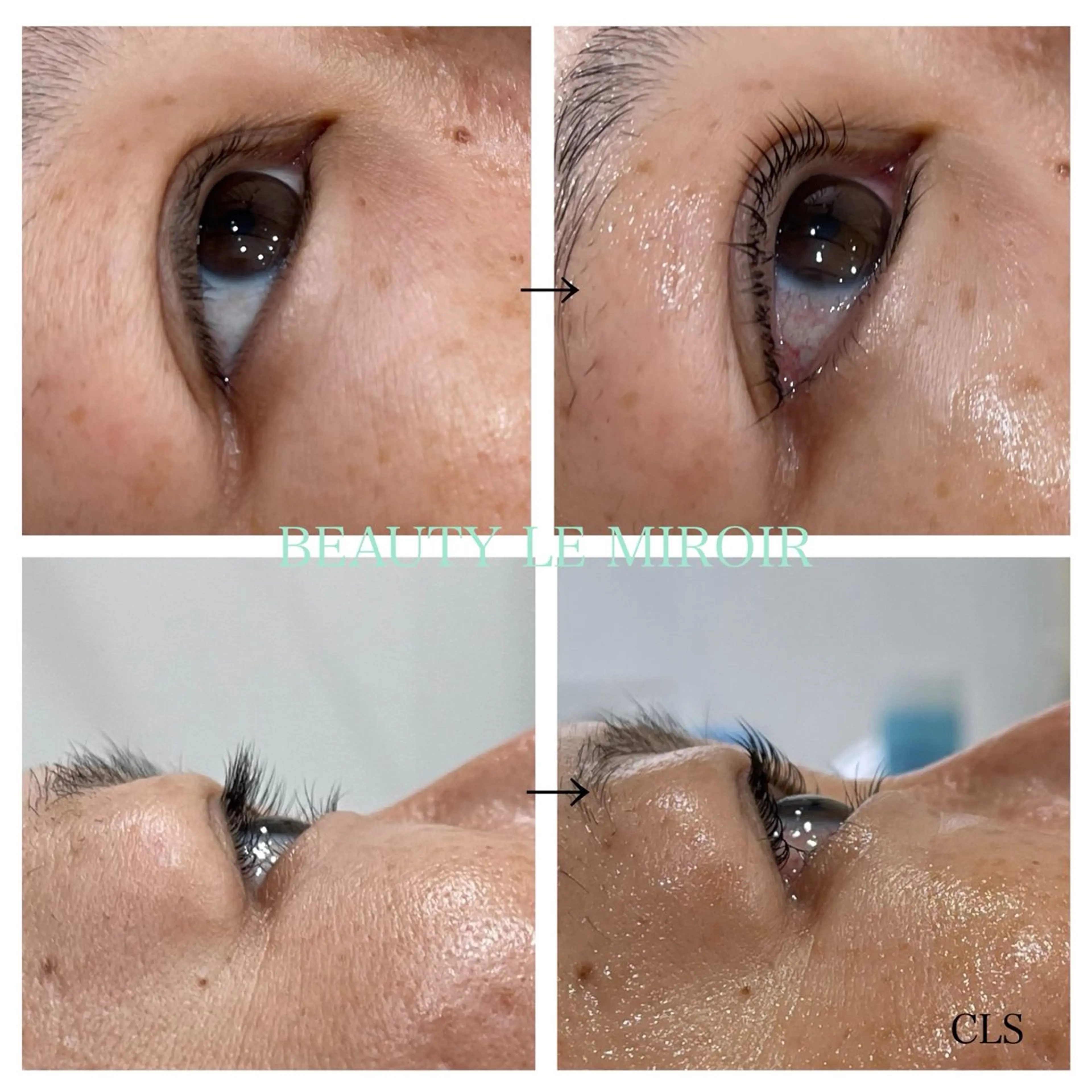 マツエク・マツパ ビューティー ミロワールのエステ・リラクイメージ