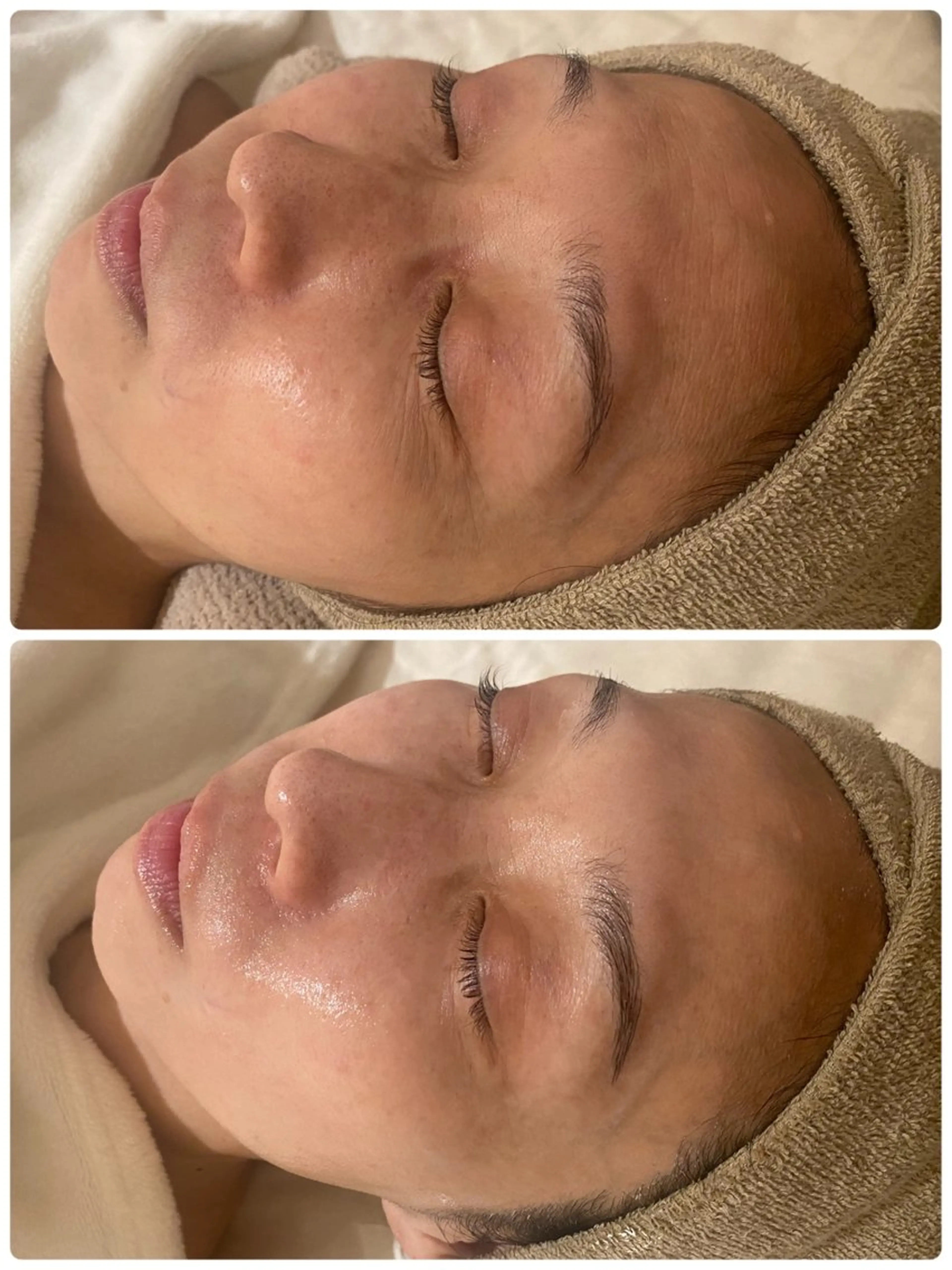 中目黒ハーブピーリン グ🌿ララピールのエステ・リラクイメージ