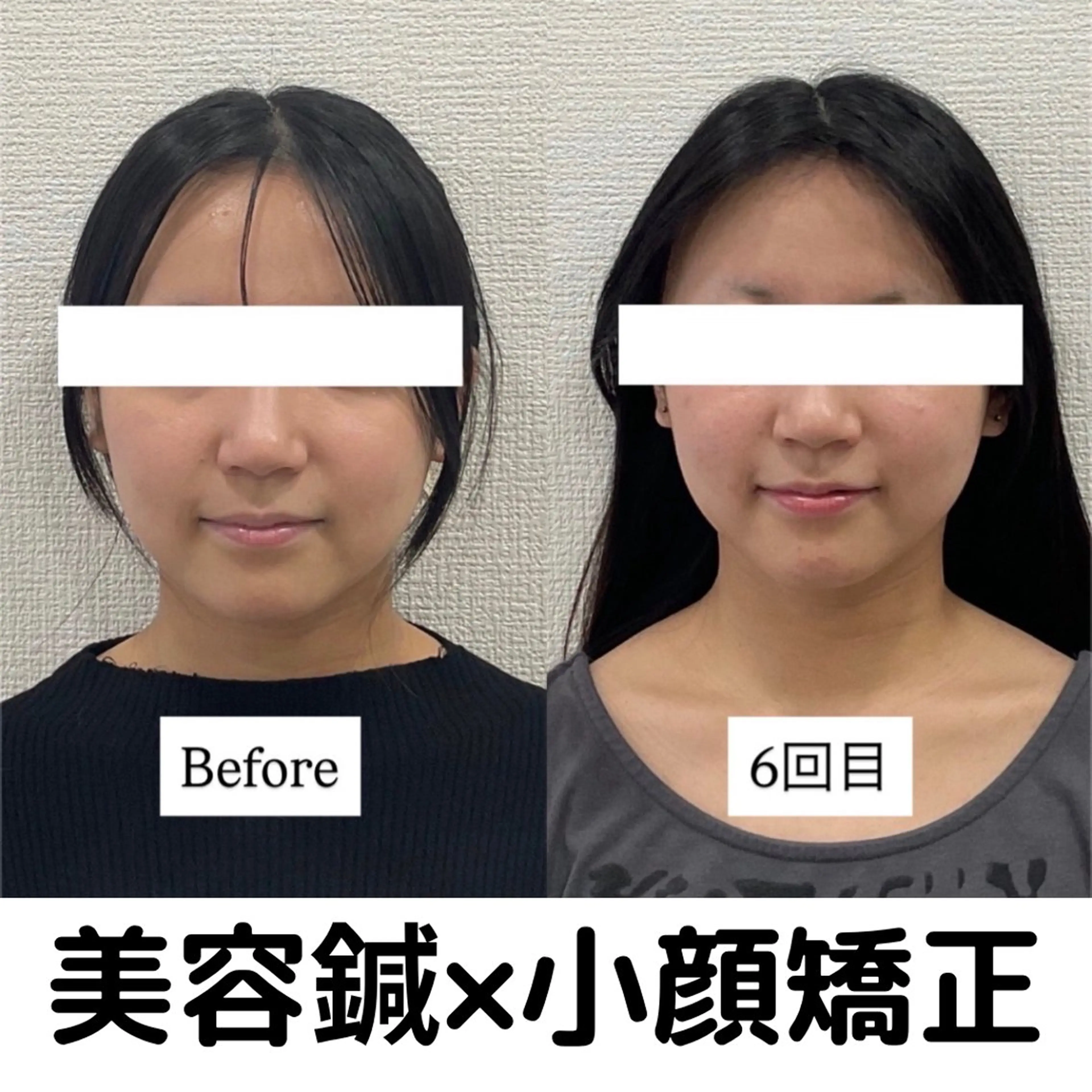 リラク 美容鍼×小顔×整体× ブライダル 大阪梅田のエステ・リラクイメージ