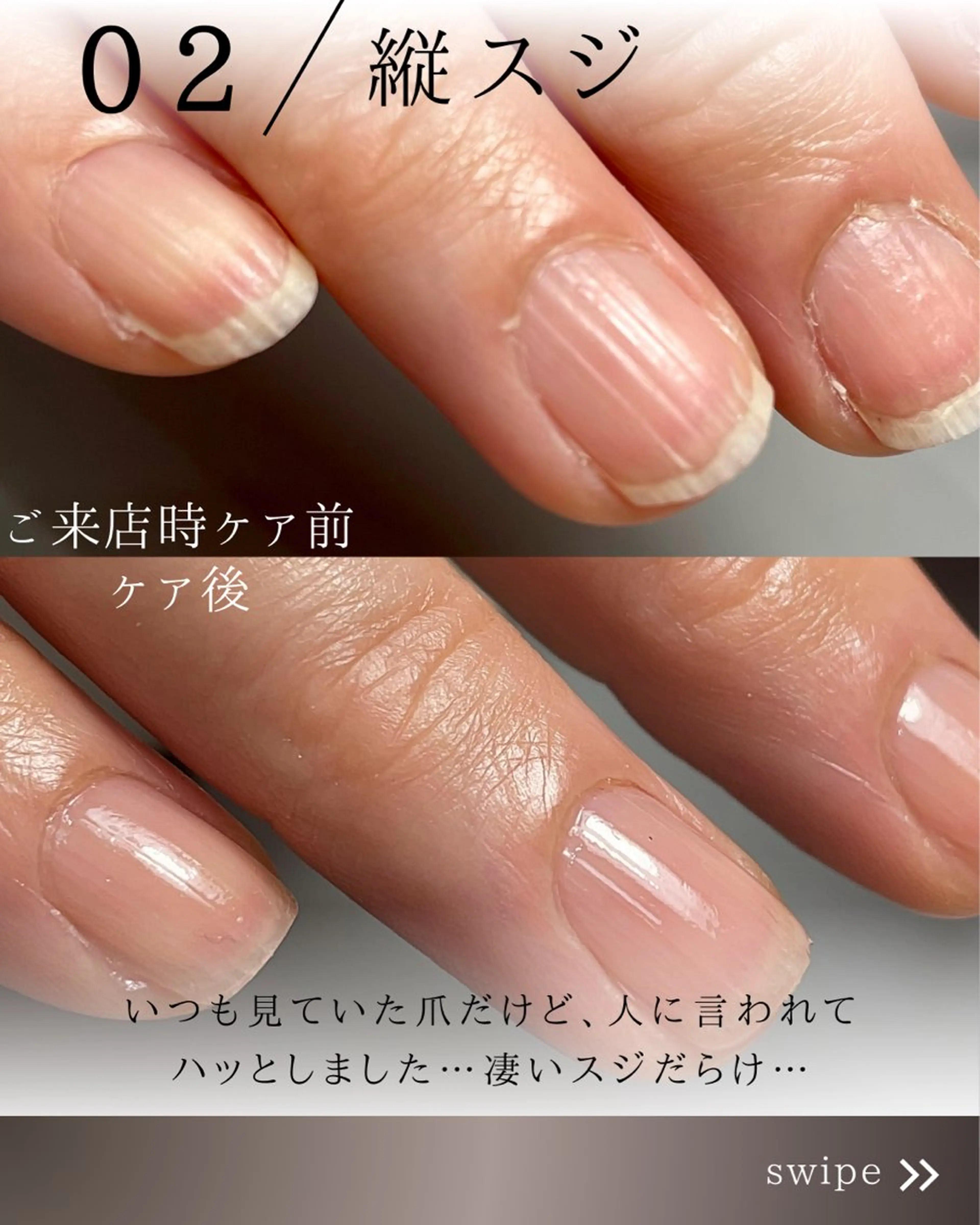 ネイル Aim* 深爪自爪育成専門店のネイルデザイン