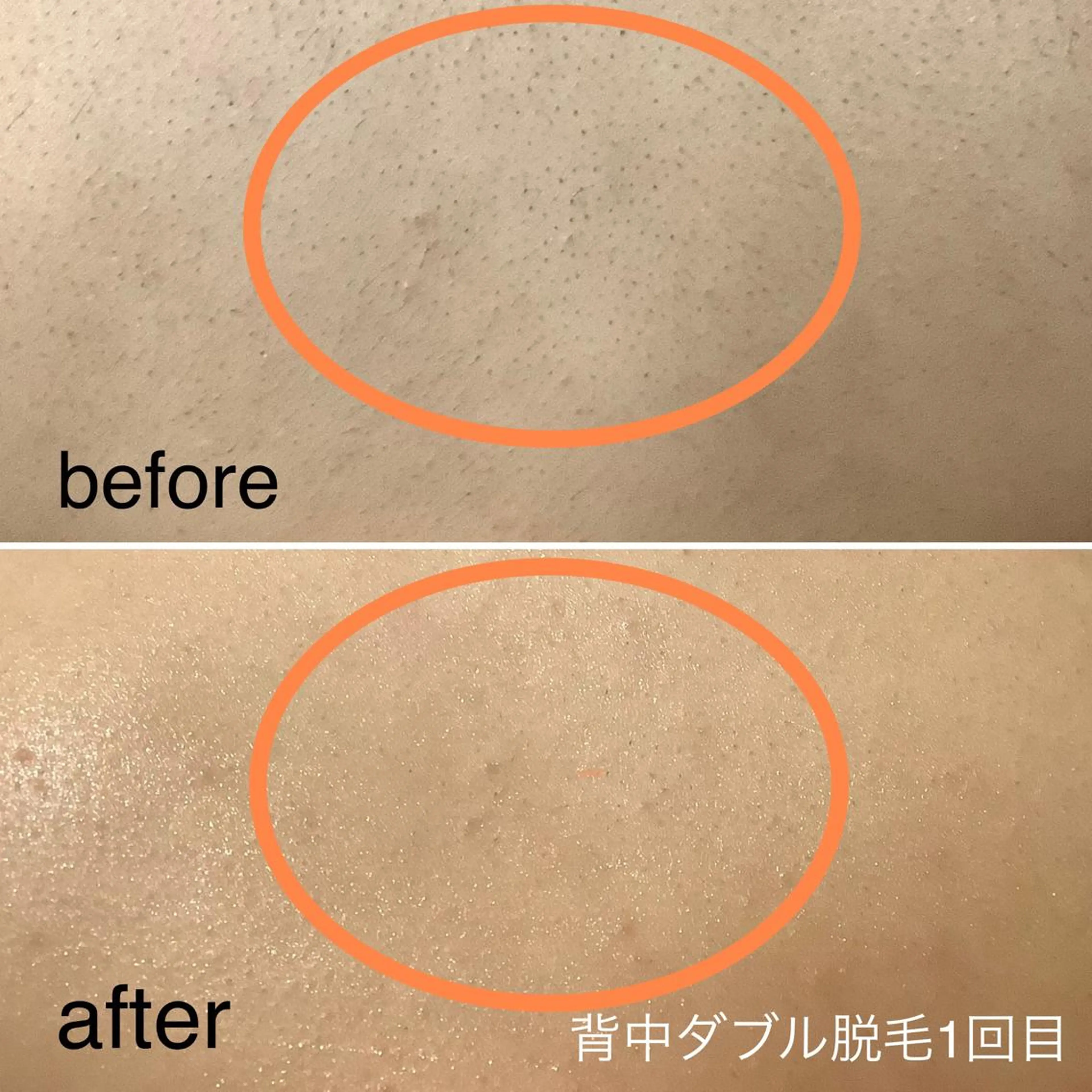 脱毛 脱毛＆エステサロン JIGGLY☆松田のエステ・リラクイメージ