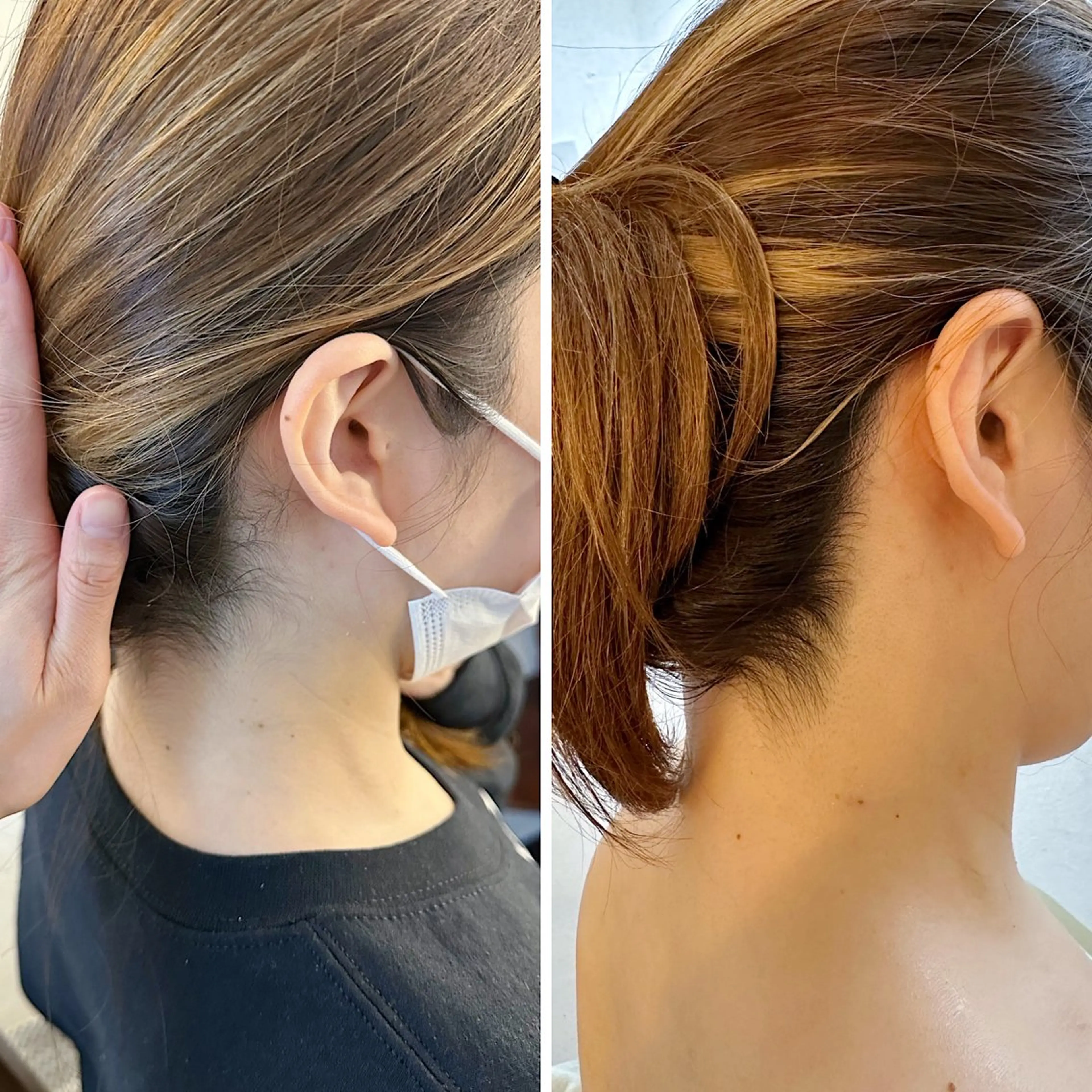 脱毛 うなじ脱毛/美肌脱毛 LABELのエステ・リラクイメージ