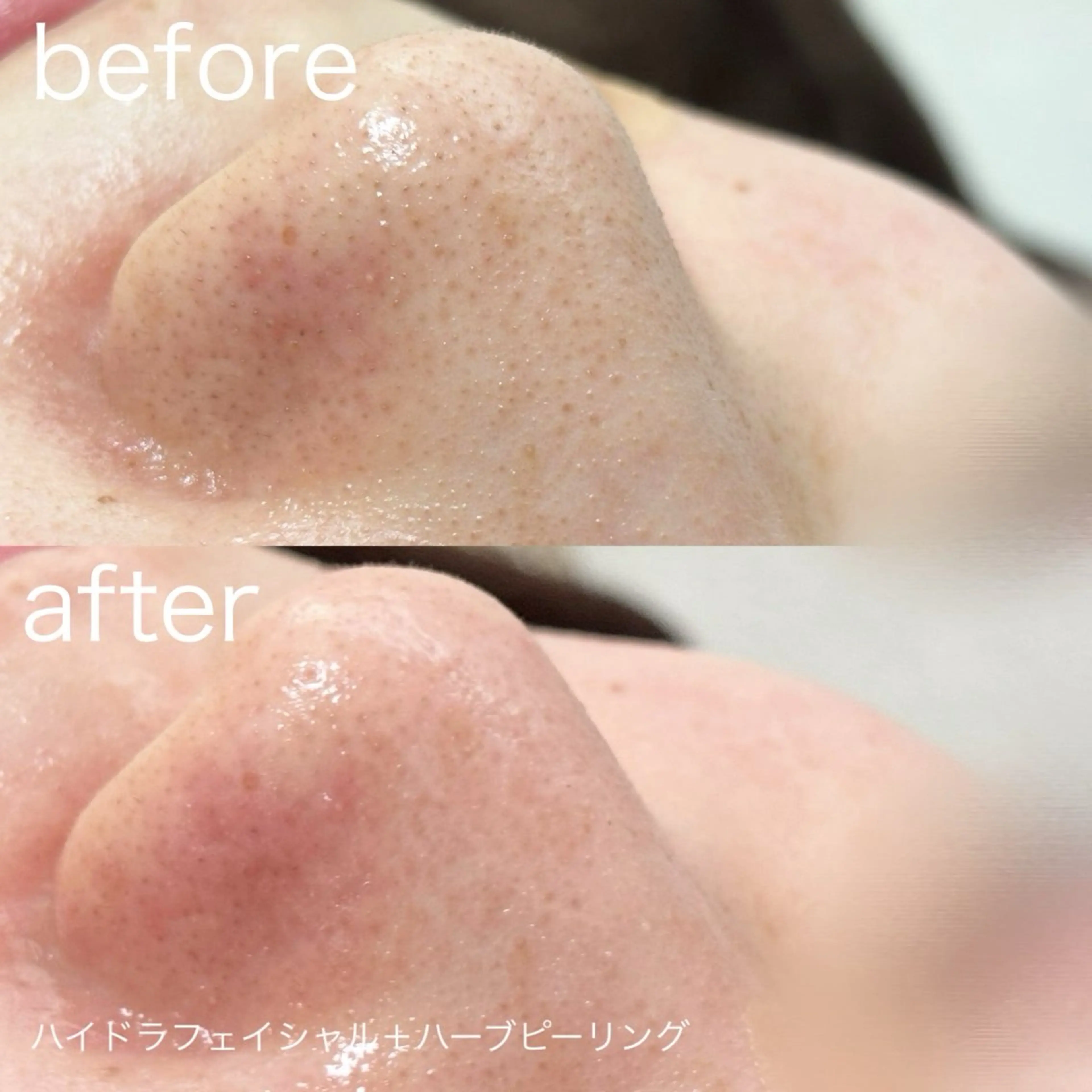 その他 lulularico Yuのエステ・リラクイメージ