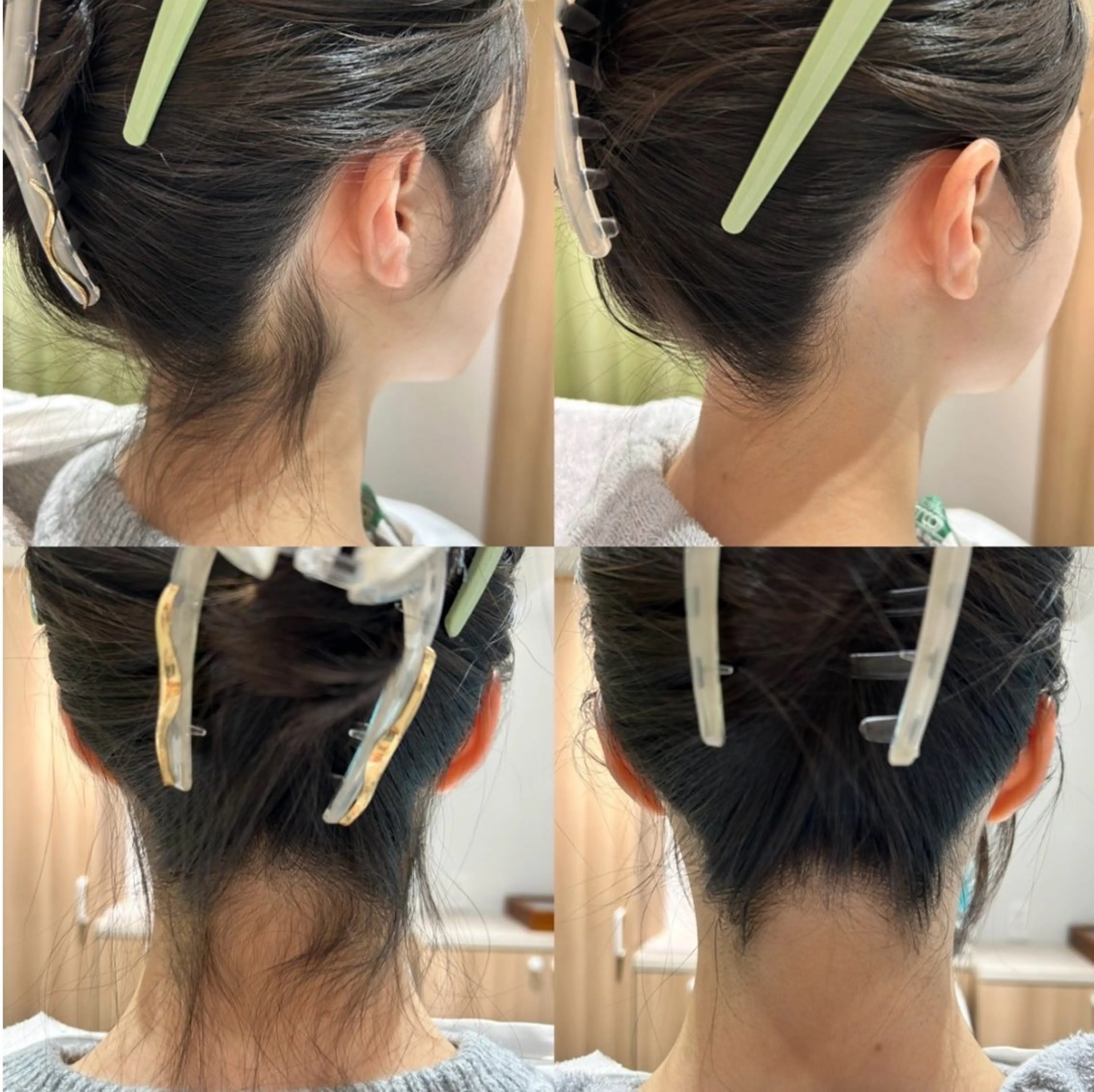 ネープクチュールの写真