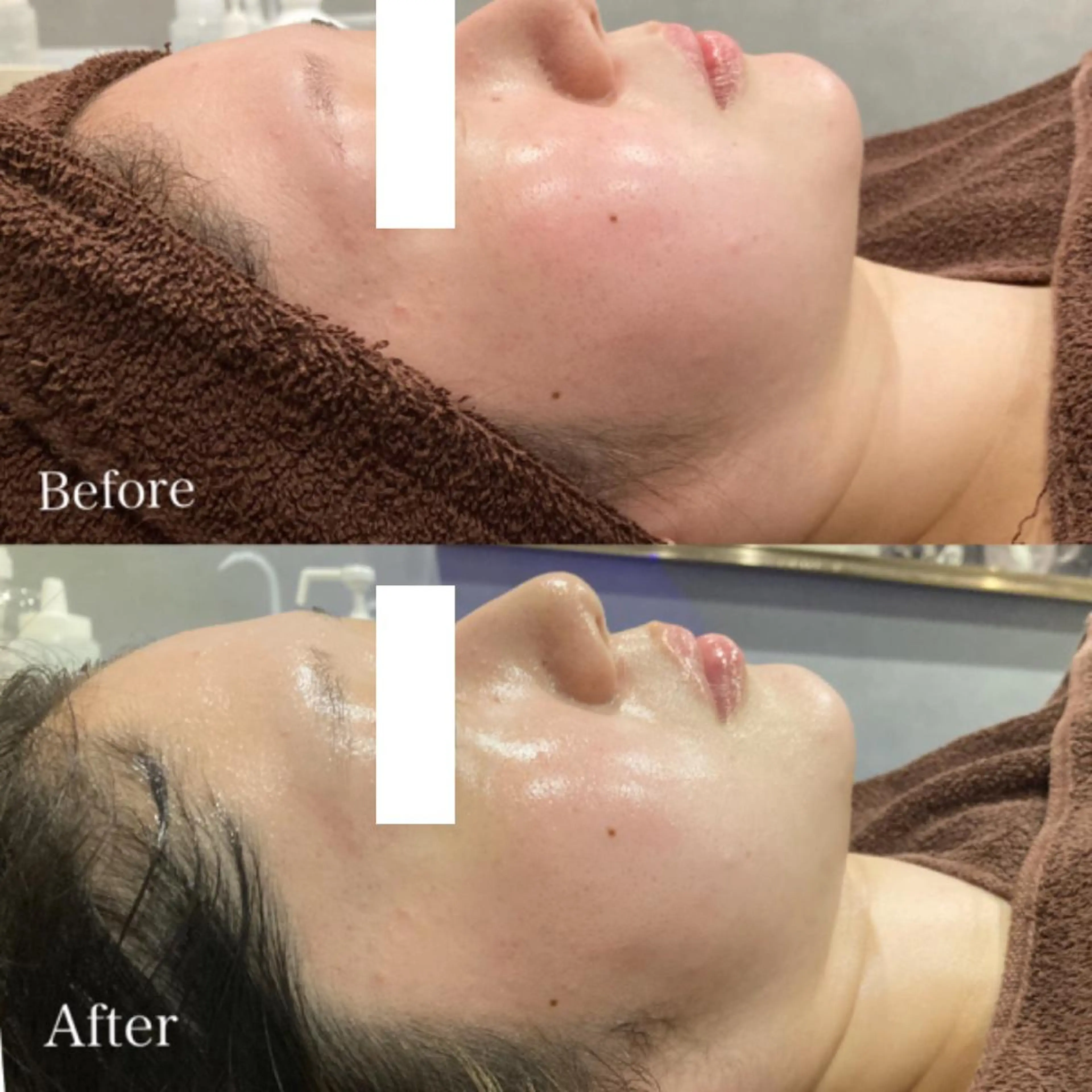 エステ Dahlia Beautyのマツエク・マツパデザイン