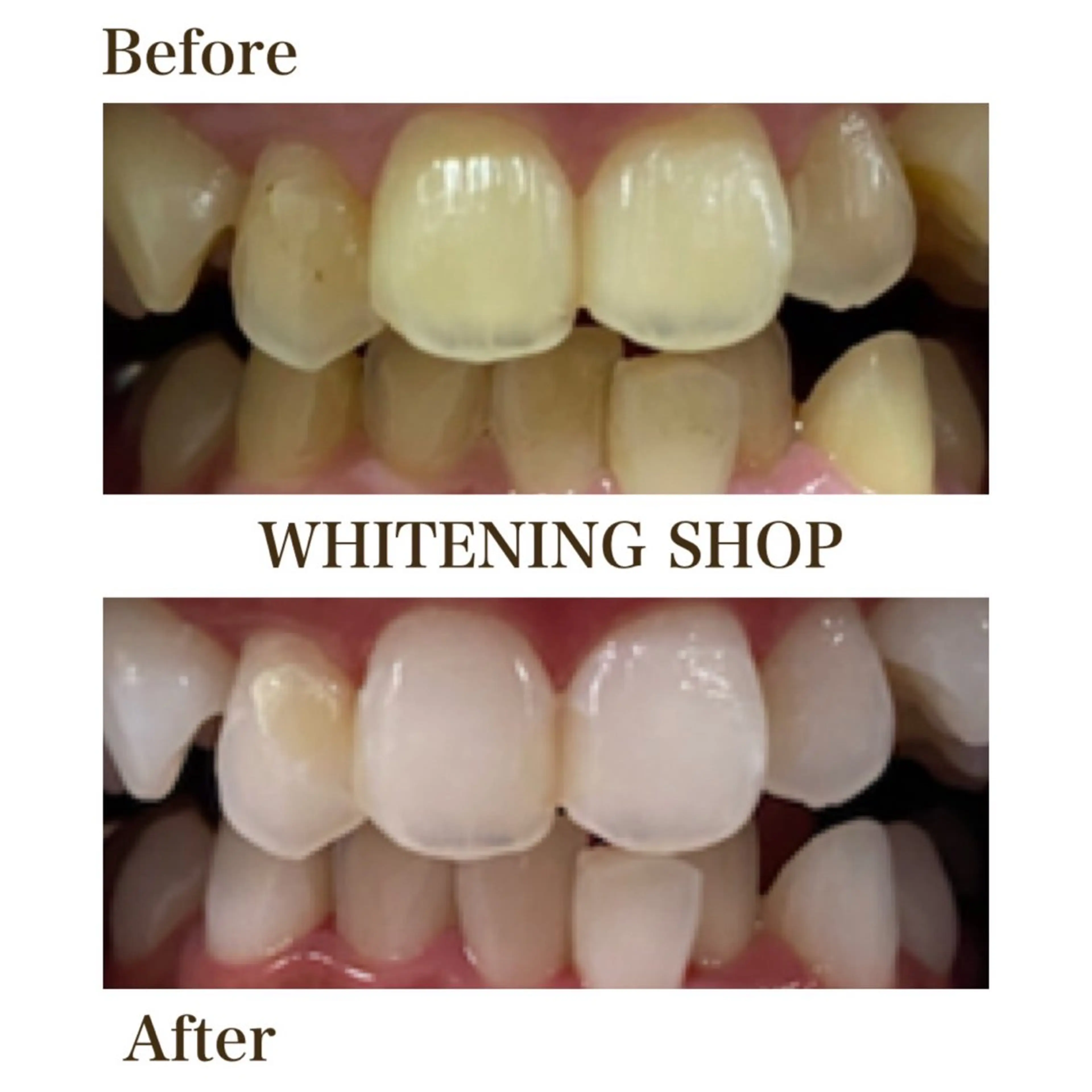 メンズ エステ リラク ホワイトニング ショップ川越店のエステ・リラクイメージ