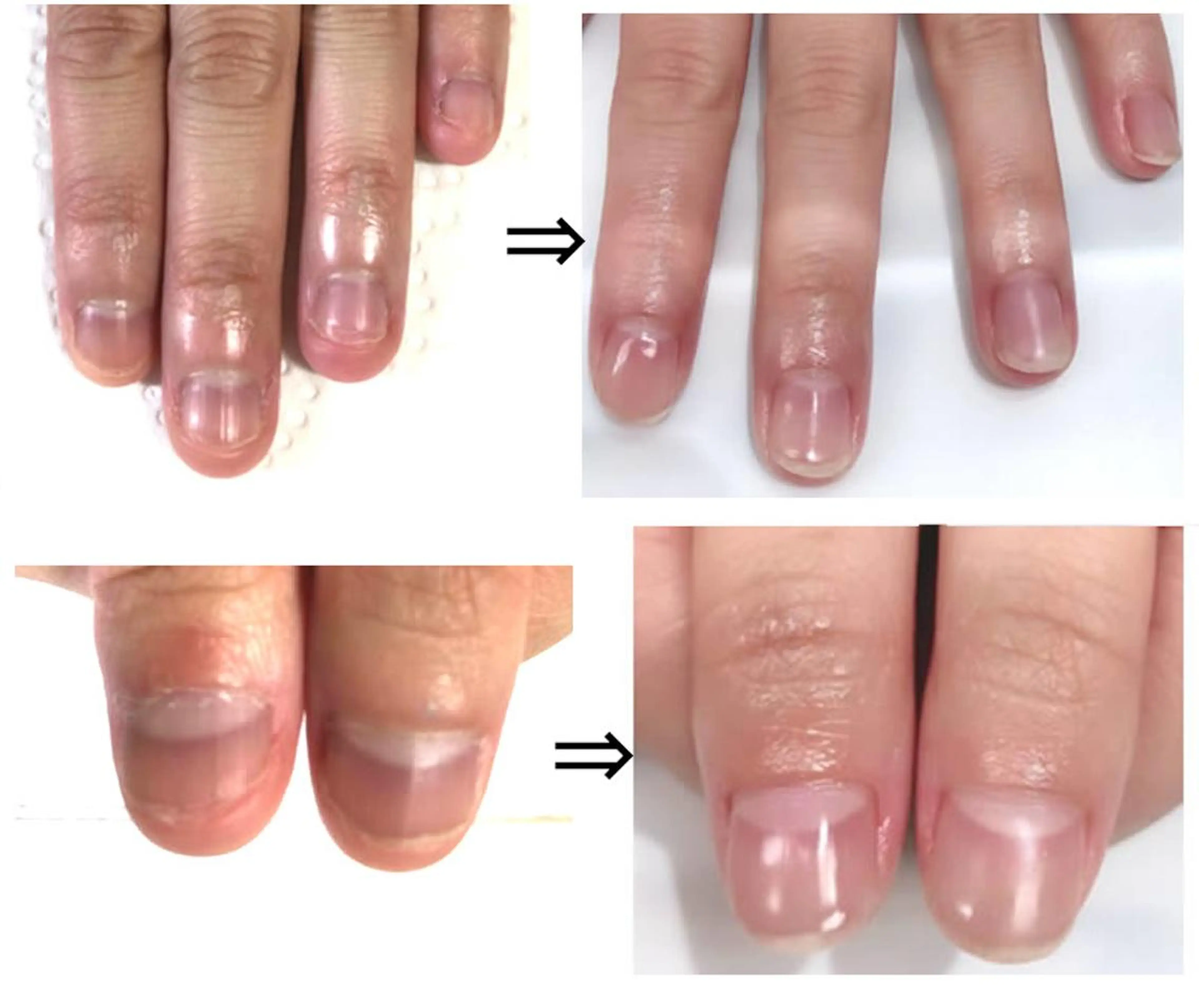 ネイル イワサキ のネイルデザイン