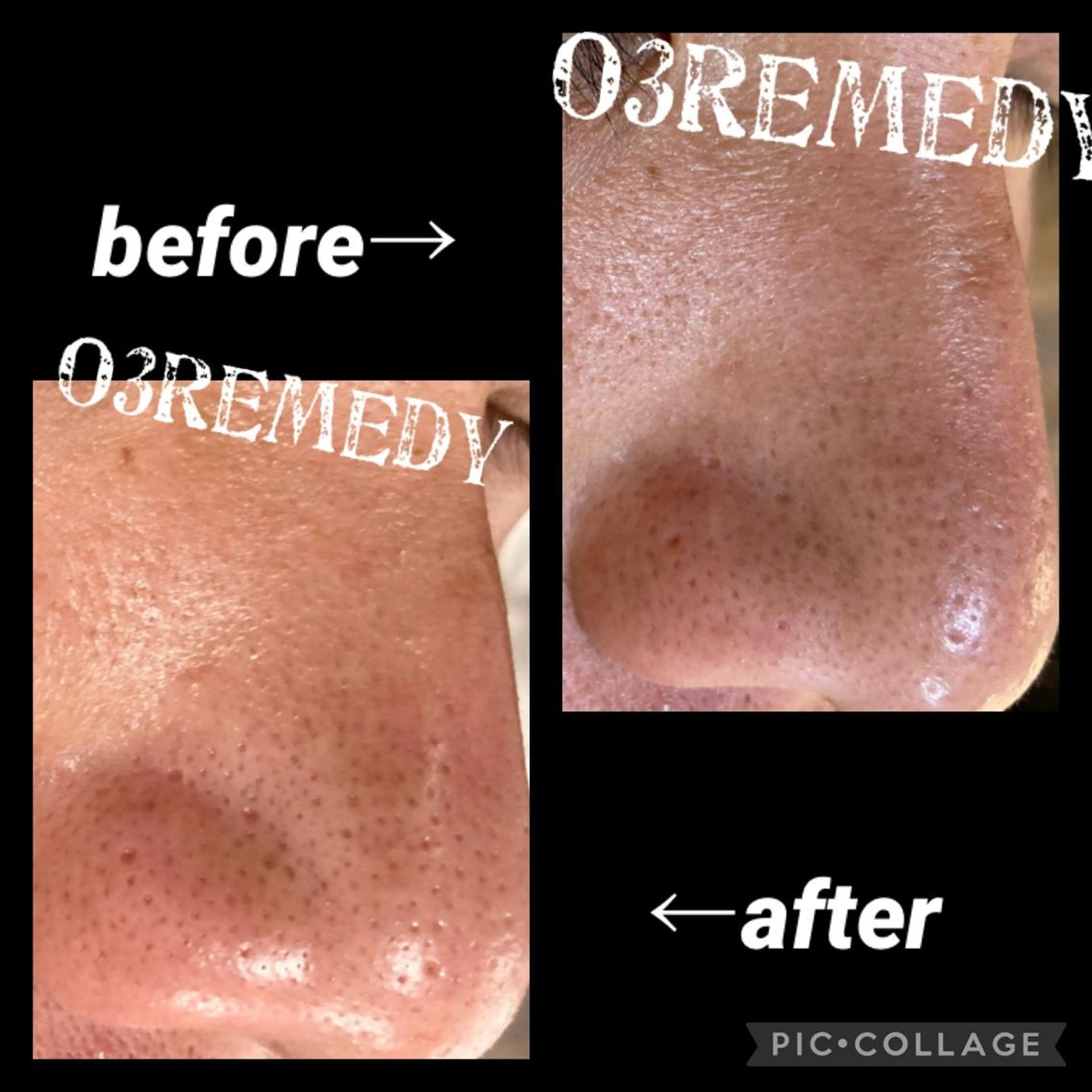 エステ o3remedy所属・宇野澤 彩加のエステ・リラクイメージ