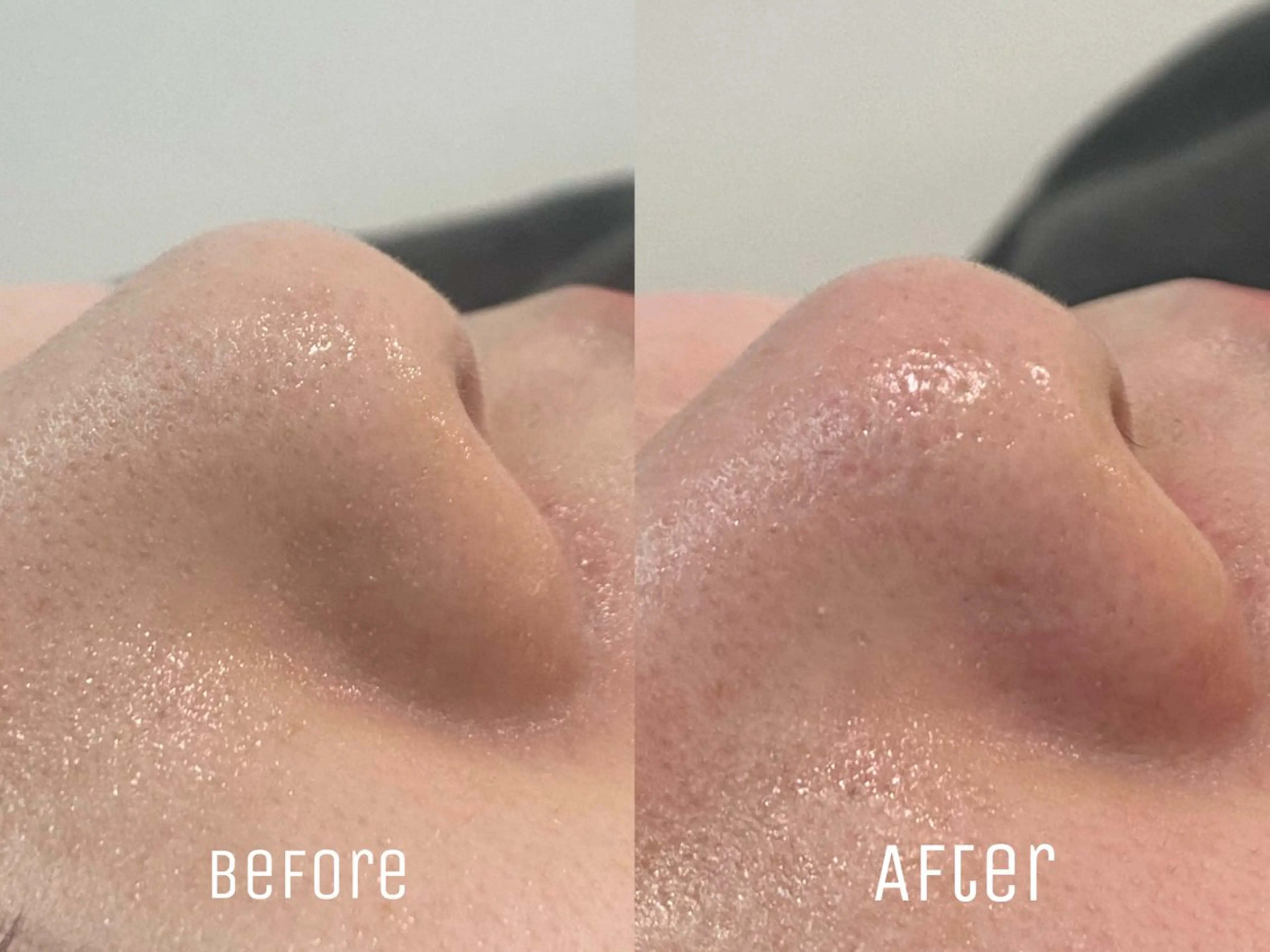 ニキビ・毛穴・肌荒れ &me 西宮北口店のその他イメージ