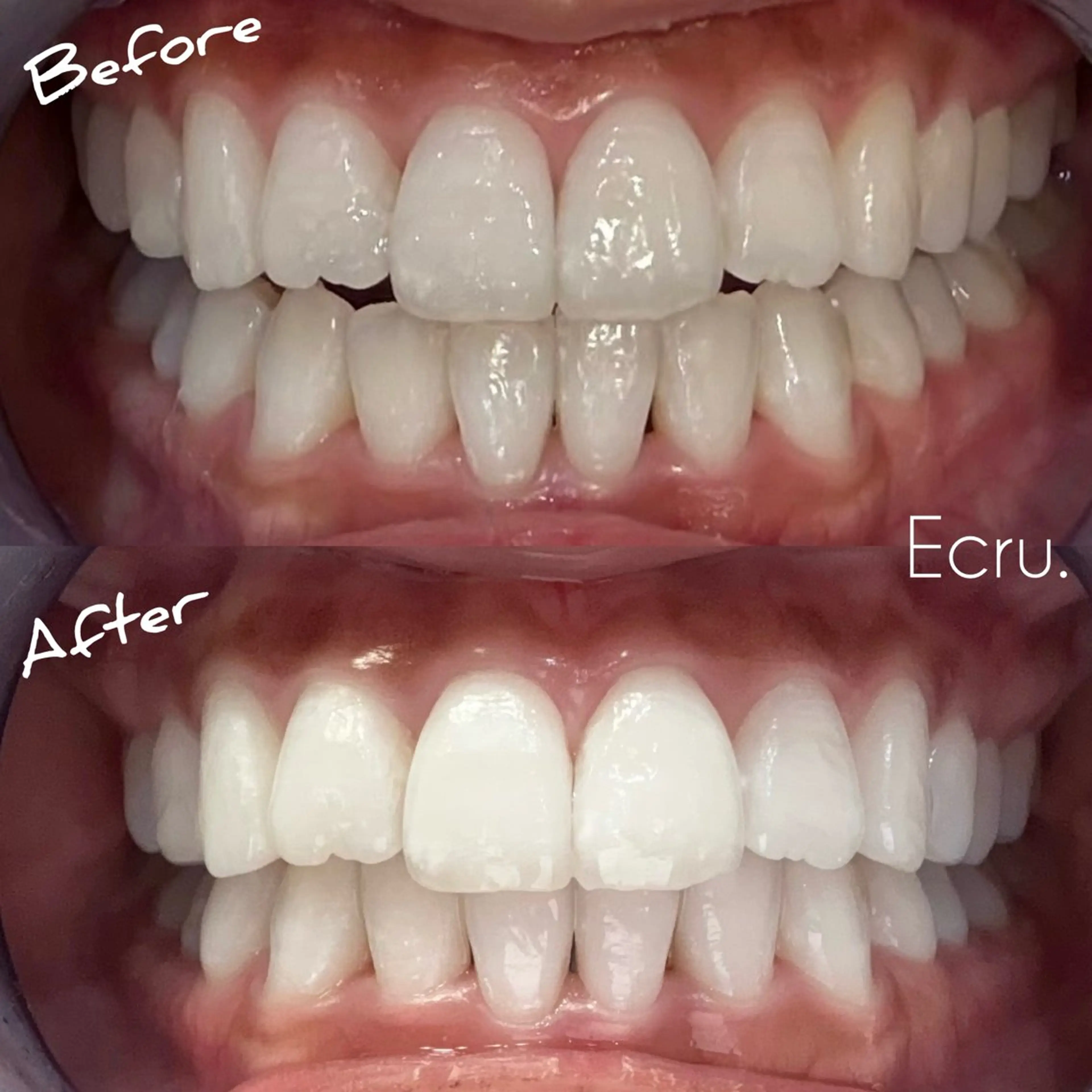 メンズ キッズ ホワイトニングサロン Ecru エクリュのその他イメージ