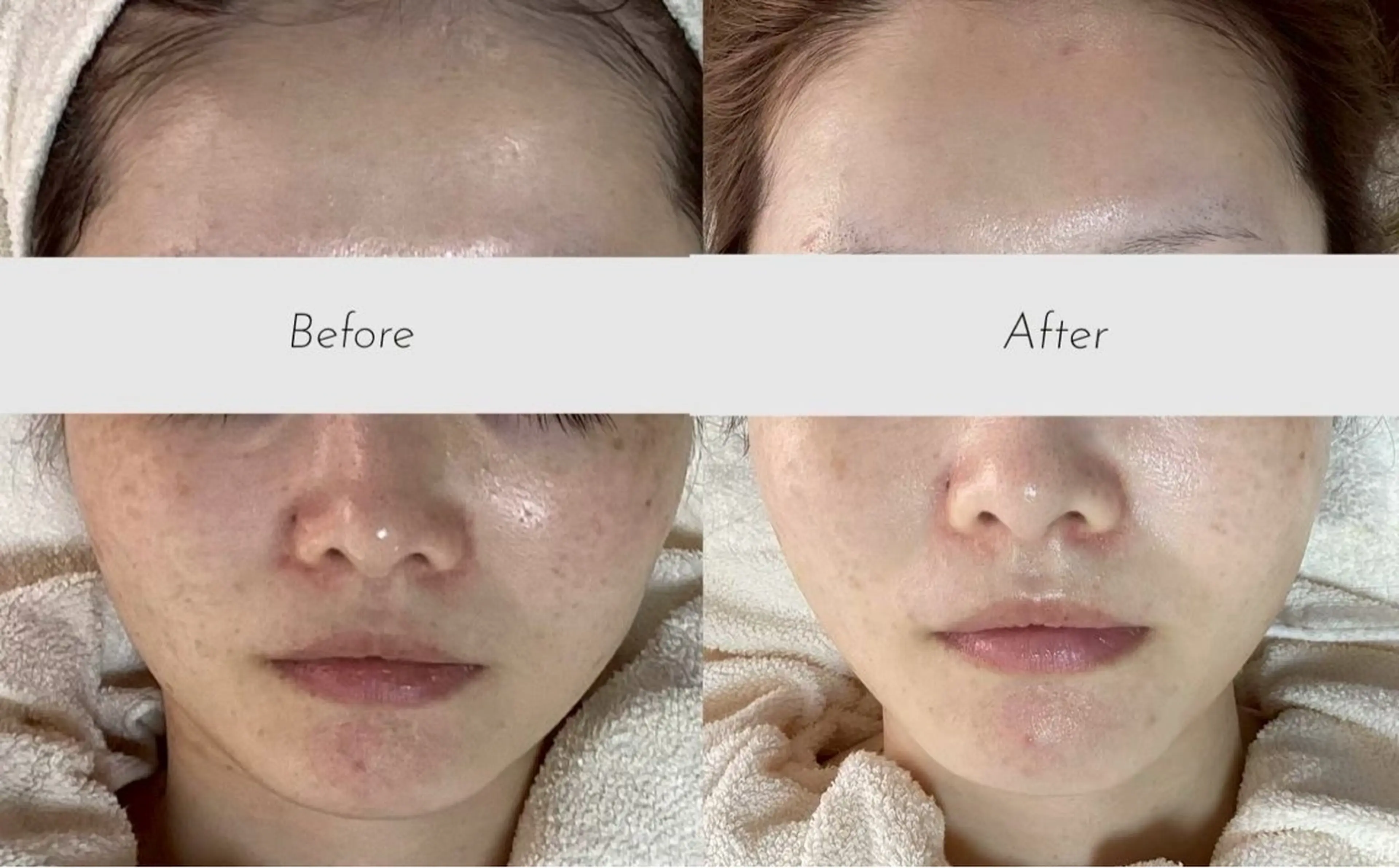 エステ 都度払い 肌質改善専門サロンのエステ・リラクイメージ