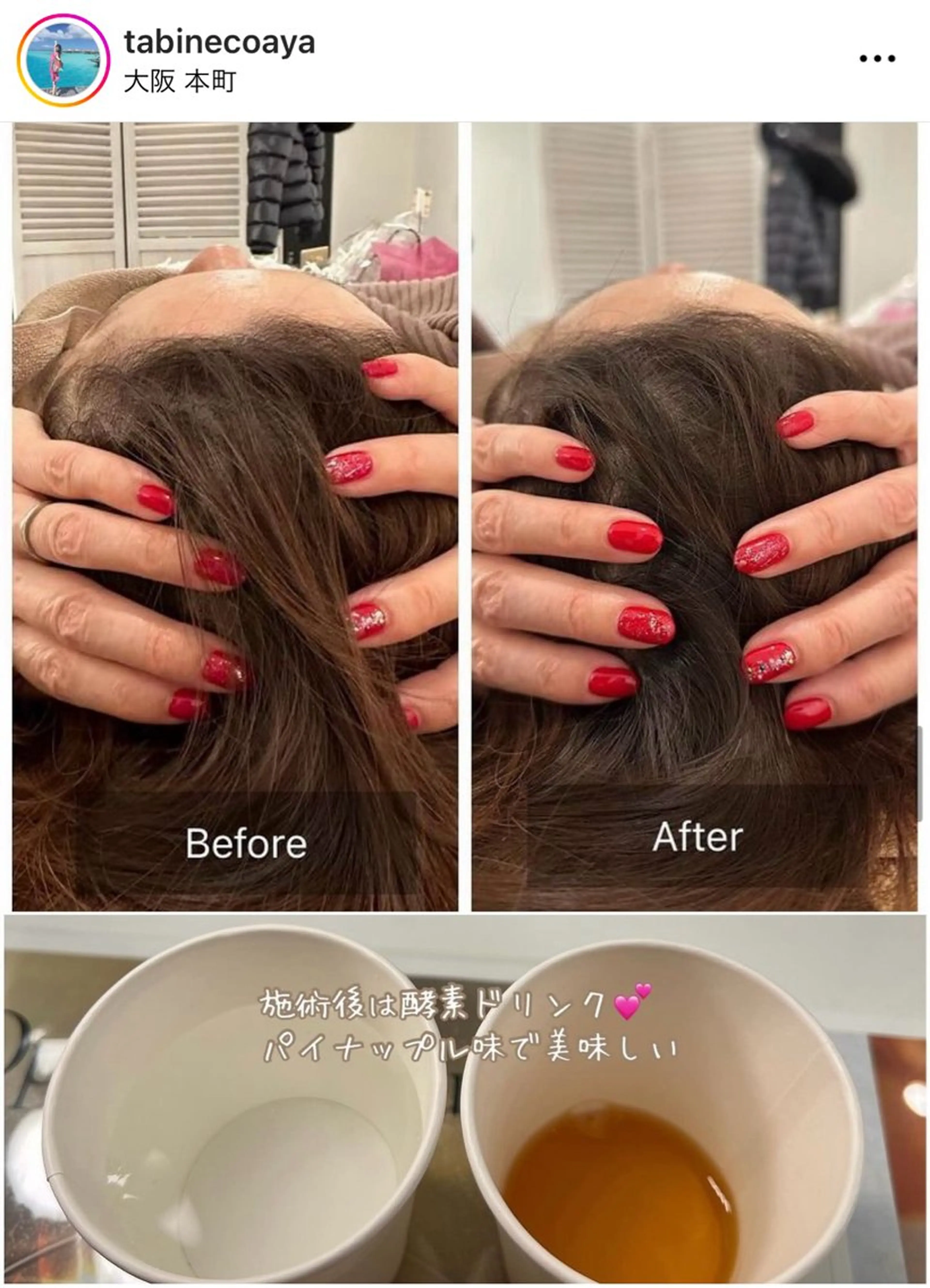 エステ リラク ANERA Second所属・尾上 沙織のエステ・リラクイメージ